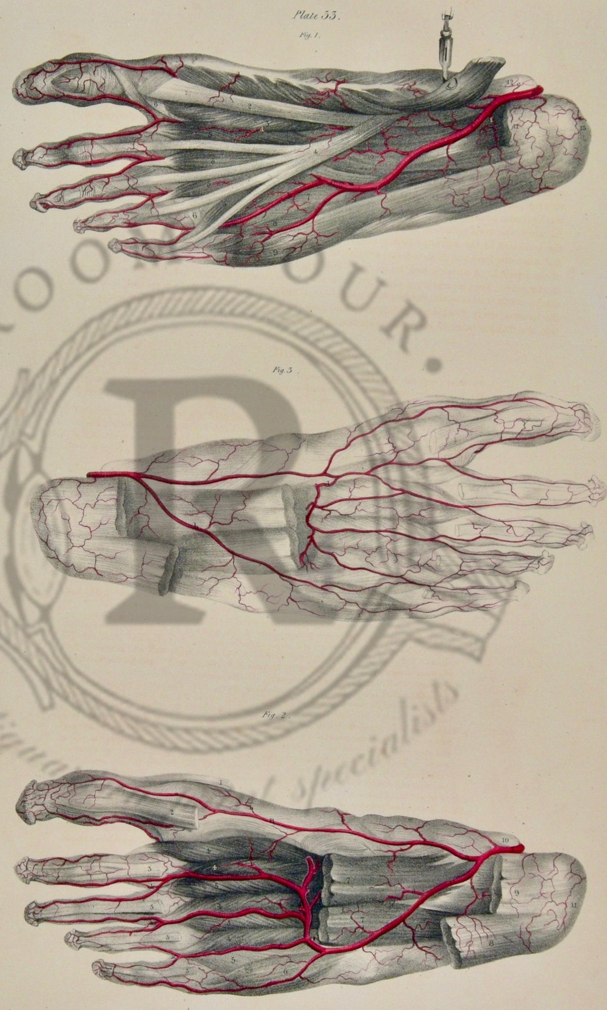 19th - Century Anatomical Drawing – Original Surgical Illustration - Quain Plate 33 - Room Four