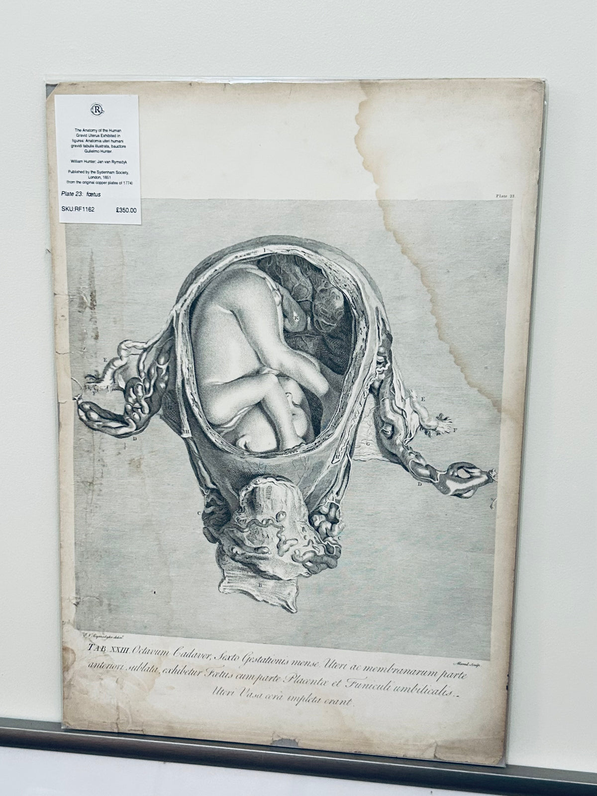 Menschliche Gebärmutter in der Schwangerschaft – Anatomische Zeichnungen von William Hunter, Tafel 23
