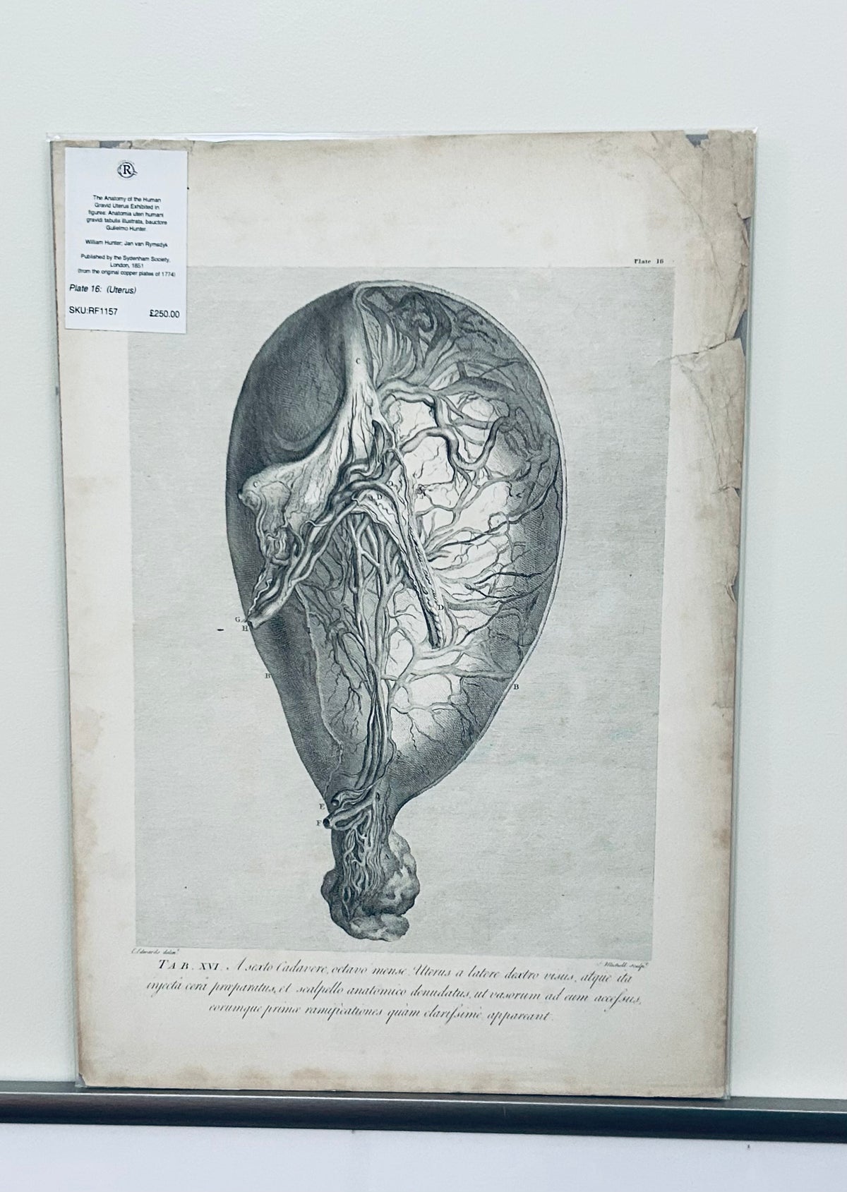 William Hunter Anatomical Original Drawing Human Gravid Uterus - Tab XVI Plate 16