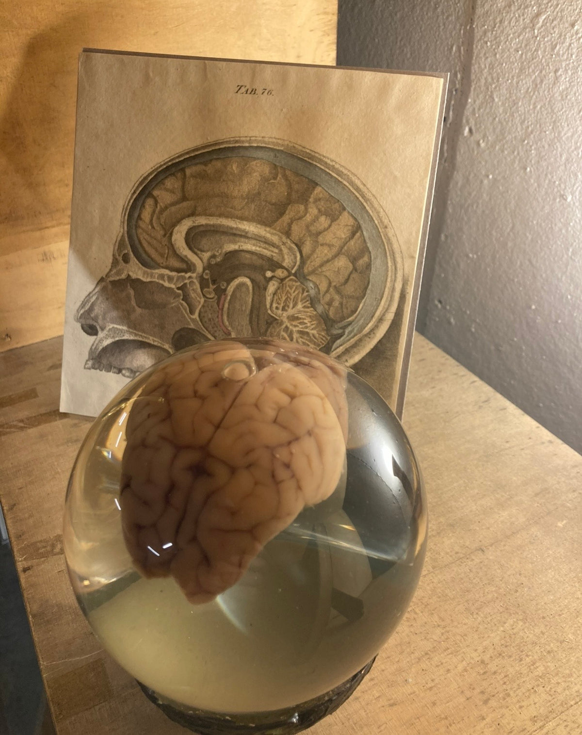 Preserved Animal Brain Specimen in Glass Orb | Taxidermy Curio POA