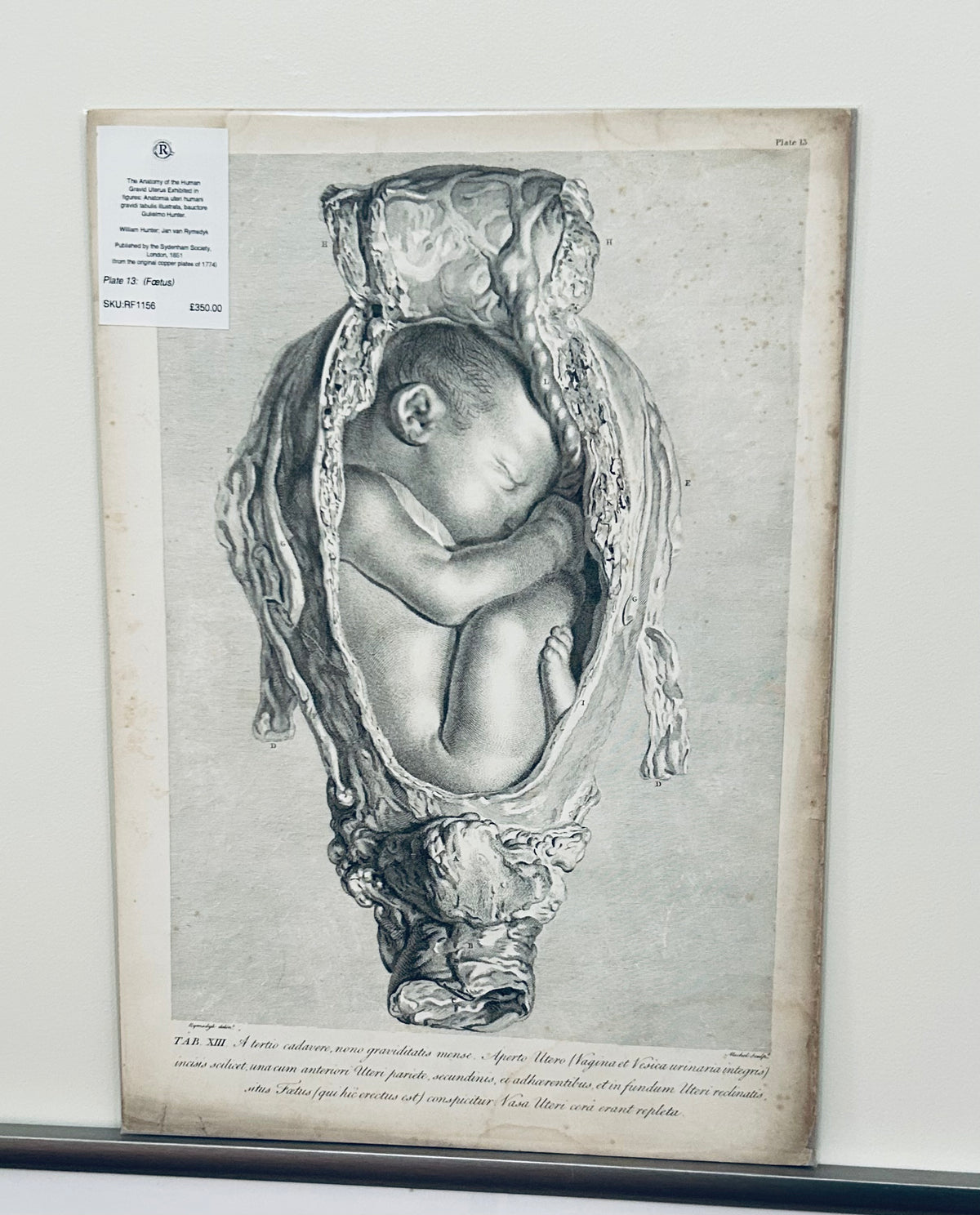 William Hunter (1774) – Original Copperplate Engraving Tab XIII Plate 13 Gravid Uterus