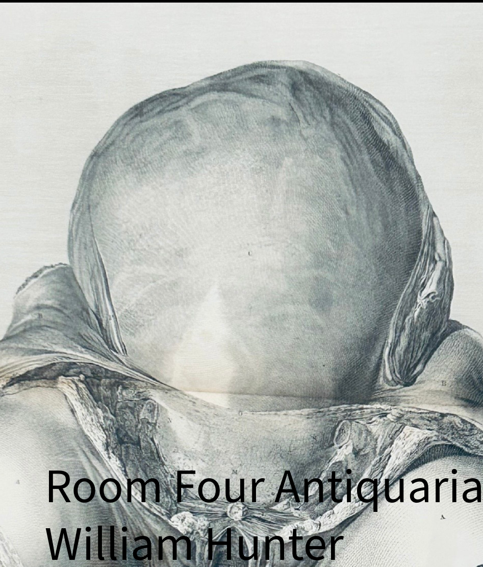 Sold - William Hunter Original Anatomical Engraving- Gravid Uterus 1851