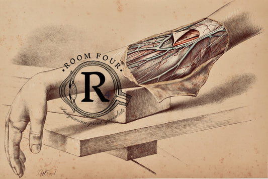 A Rare 1865 chromolithograph medical illustration of right arm flap, drawn life-size by George Henry Ford — antique anatomical print.Veins