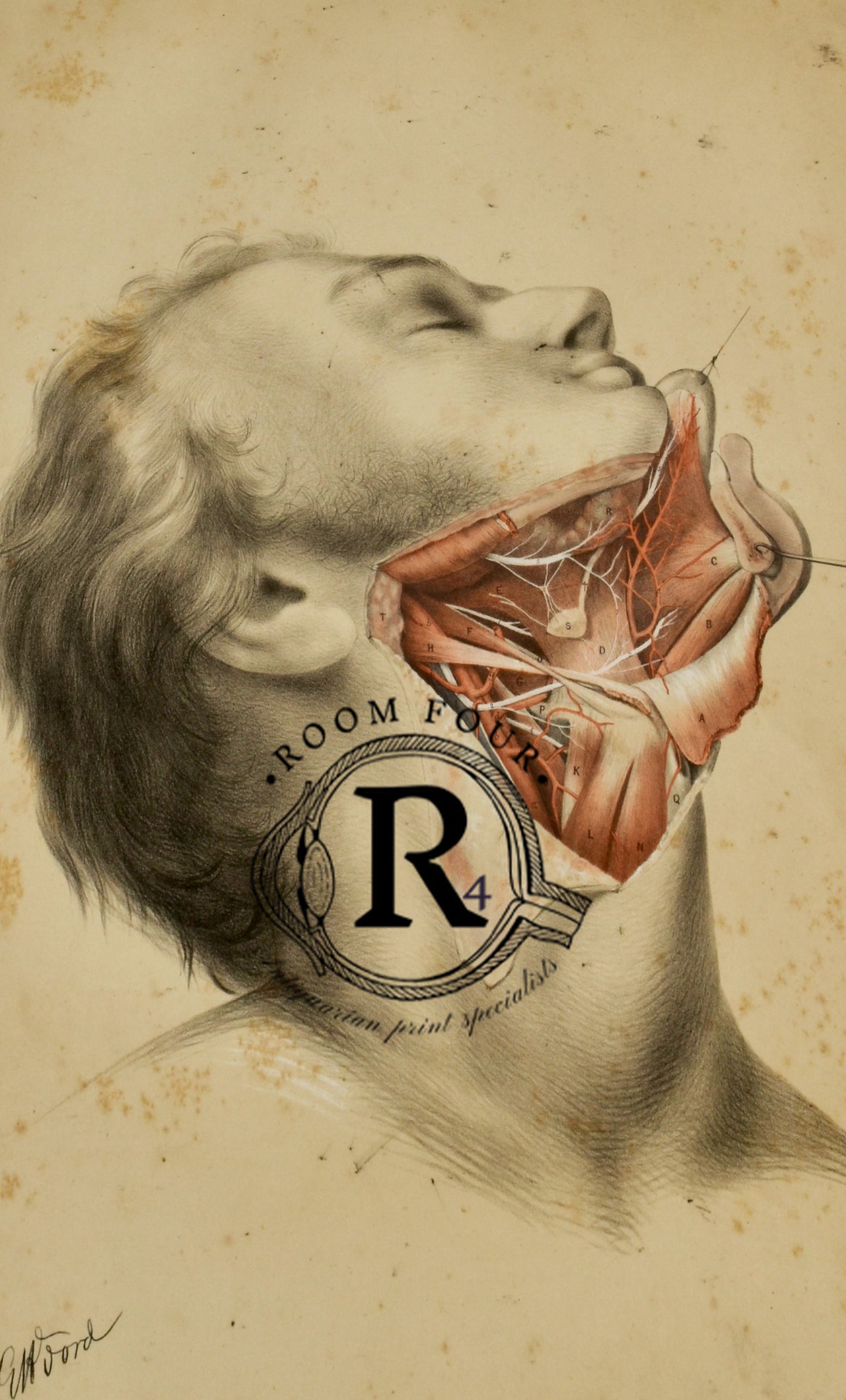 Anatomical Human Post Mortem Drawing - Neck & Jaw - 19th century - Ford