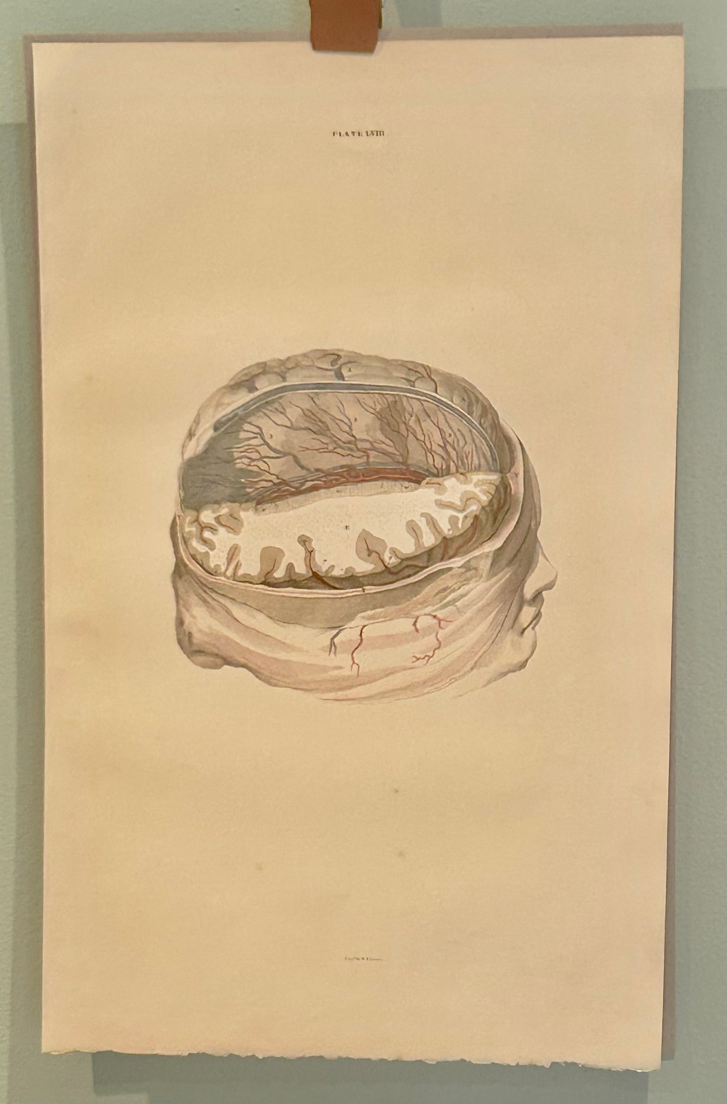 Lizars Anatomical Drawing "The Brain" - early anatomy 19th century - plate LVIII - ORIGINAL