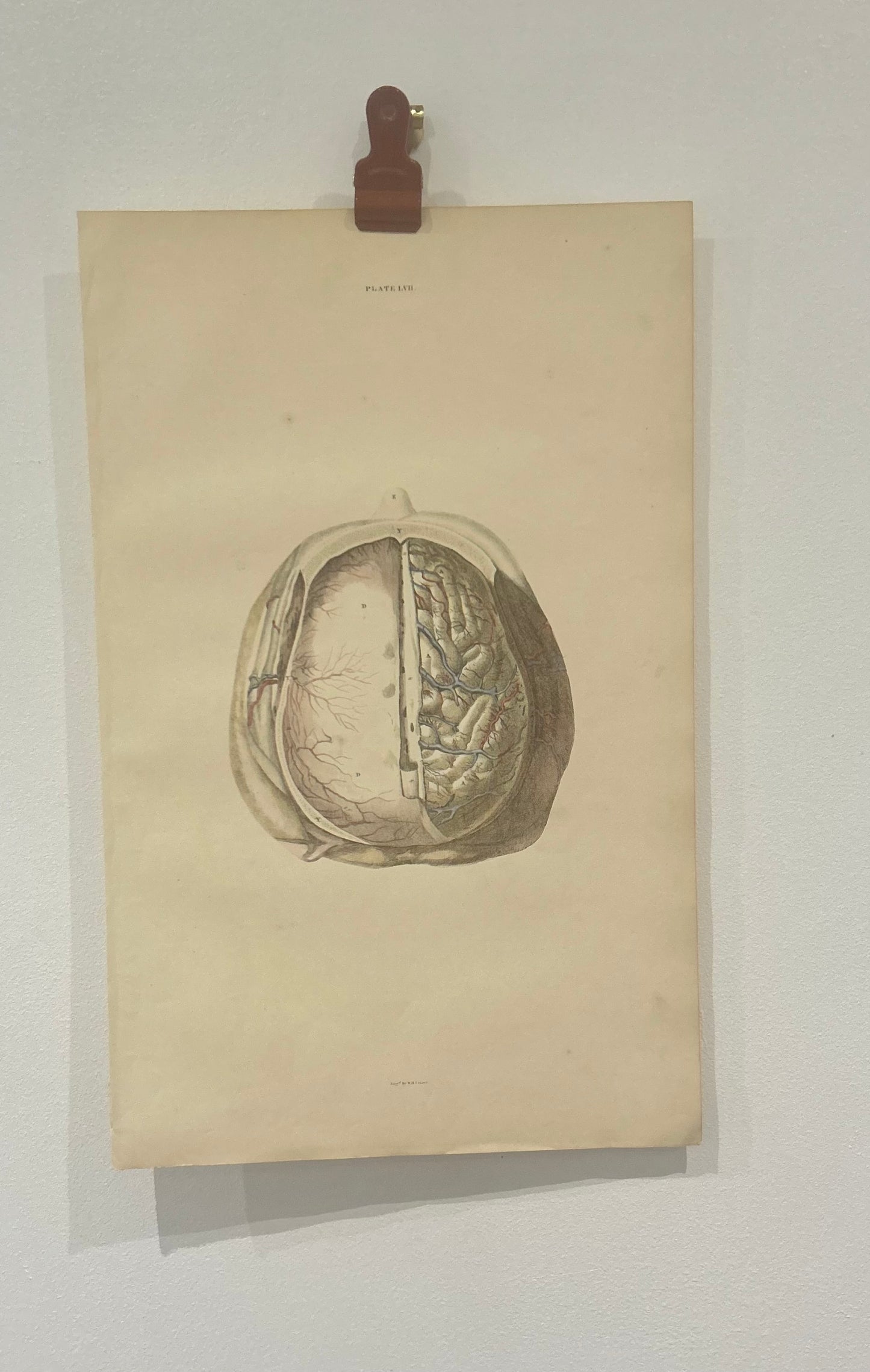 Lizars 19th Century Anatomical Illustration - The Brain - Plate LVII