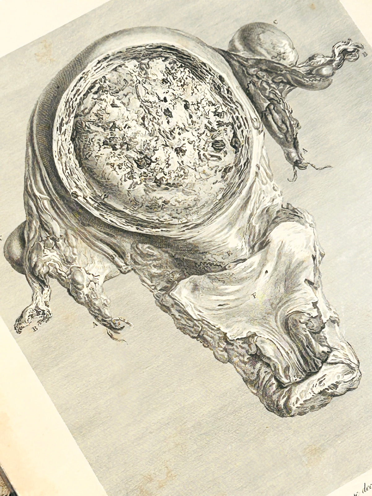 Human Gravid Uterus - William Hunter Anatomical Drawing Gravid Uterus Tab XXX Plate 30