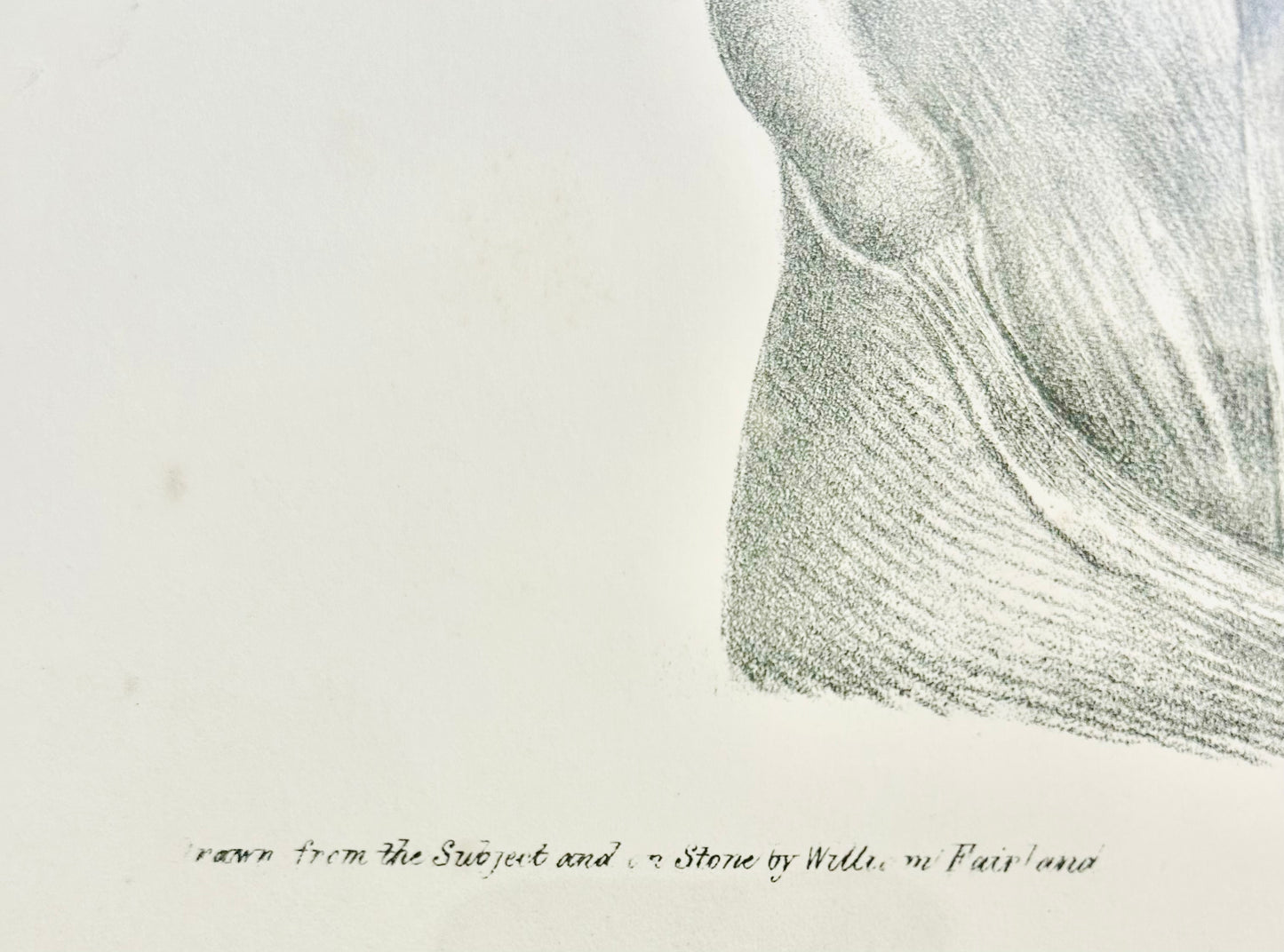 Sibson Antique Anatomical Drawing – Dissection Plate VI (1869)