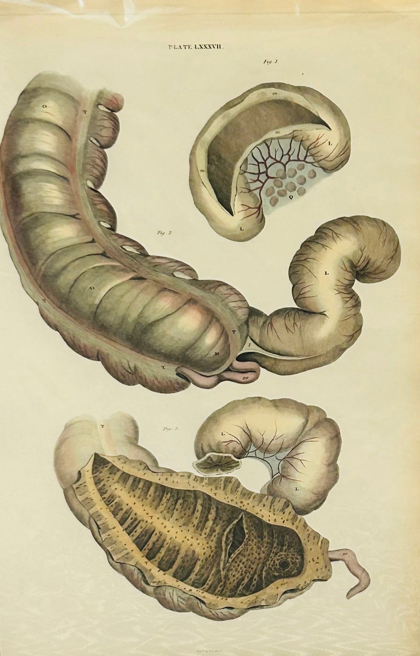 John Lizars – Original Hand-Coloured Anatomical Print (1820s) – Human Digestive System