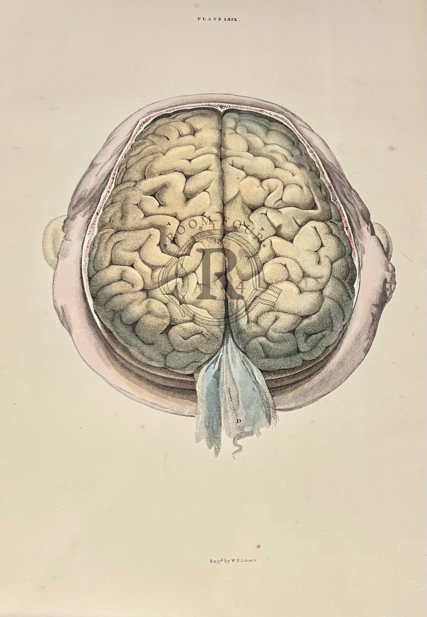 Lizars Anatomical Drawing - The Brain - 19th Century / early anatomy Plate LXIX - original