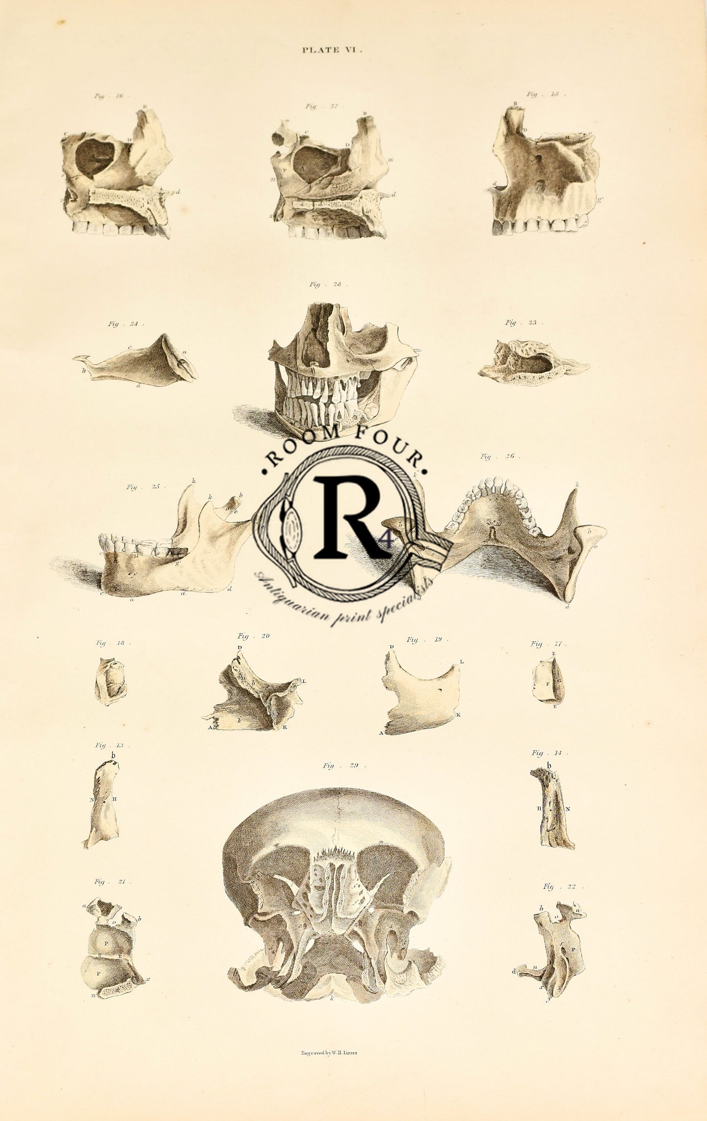 19th Century Original Anatomical Drawings by Lizars - Skull/Bones Plate VI
