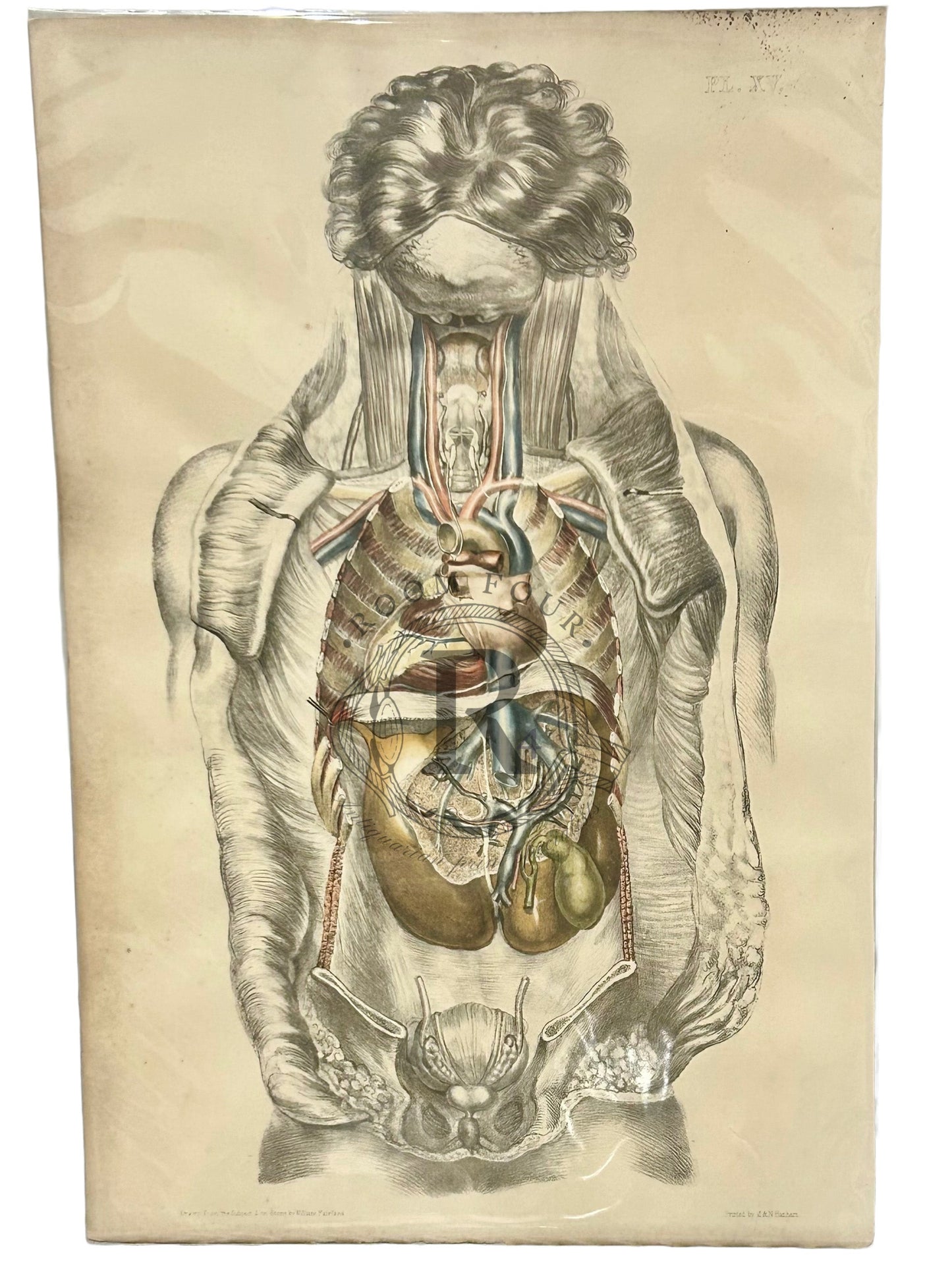 Anatomical Post Mortem Illustration by Sibson Internal OrgansPlate XV - Antique 19th Century