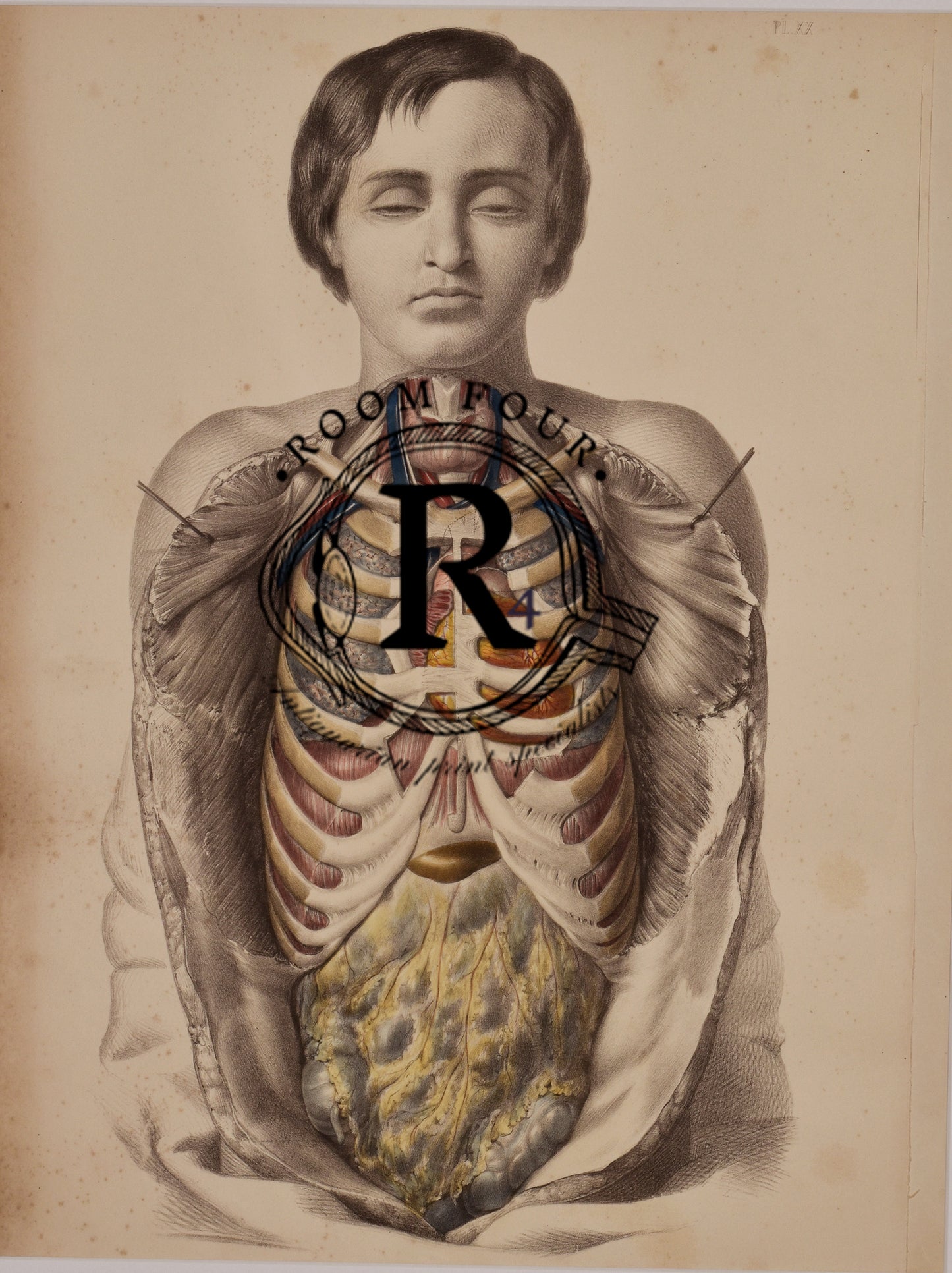 Human Anatomy Surgical Post Mortem Drawings 19th Century