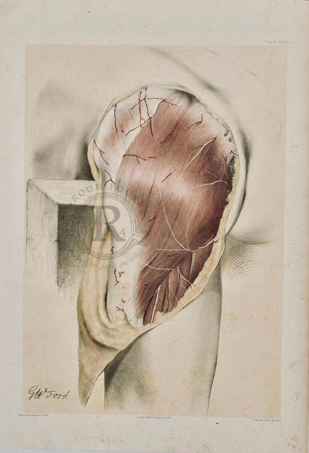 Anatomical Dissection Drawing 19th Century Plate XLVIII Maximus Gluteus - Room Four