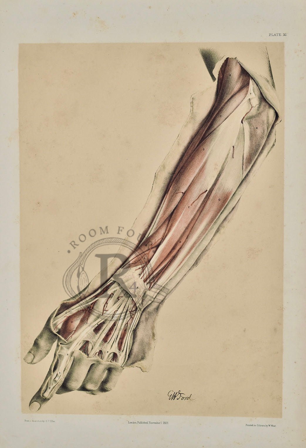 Anatomical Drawing 19th Century - Fore Arm plate XI - Room Four