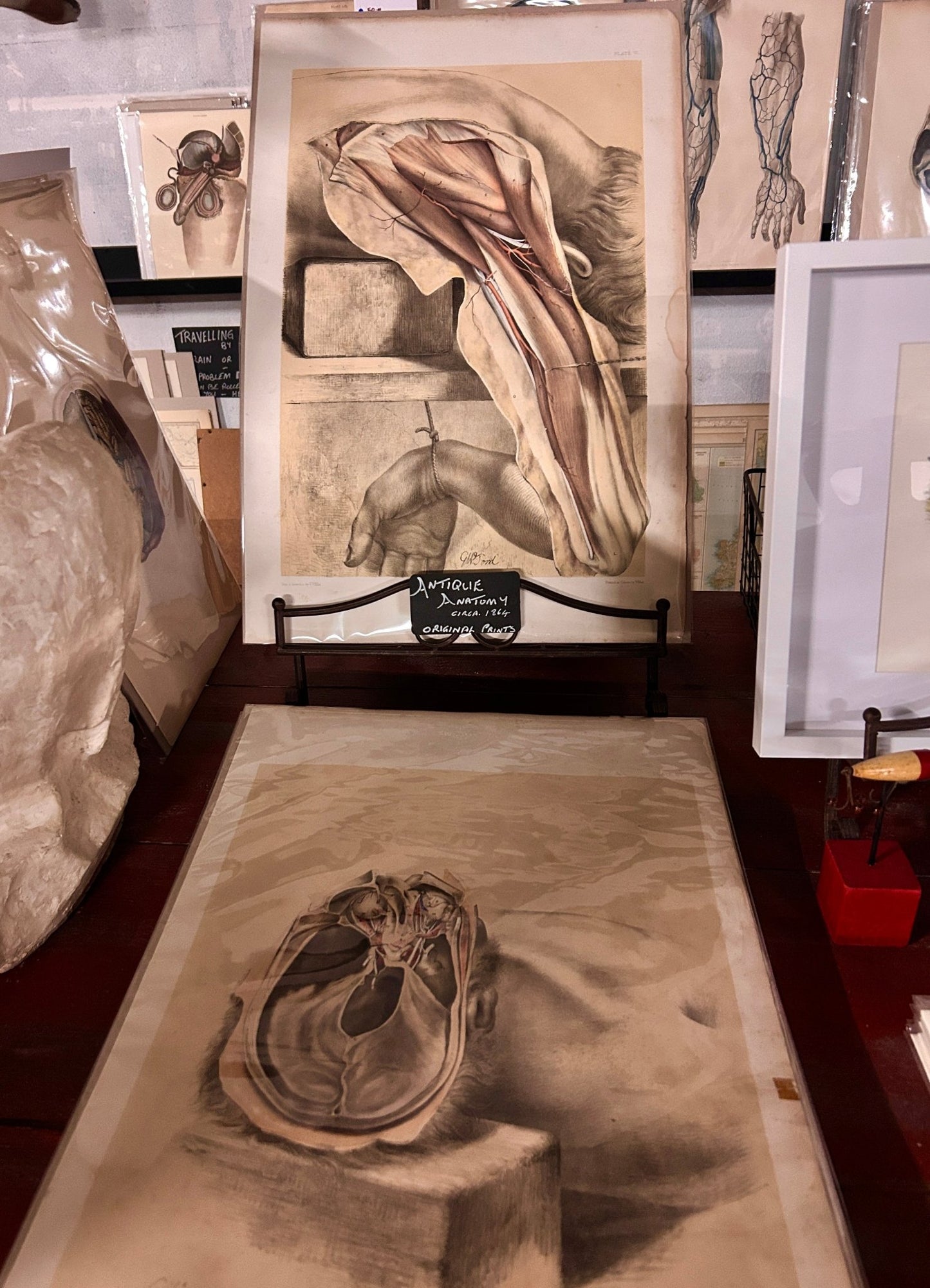 Anatomical Drawing 19th Century - Hand Dissection (plate X) - Room Four