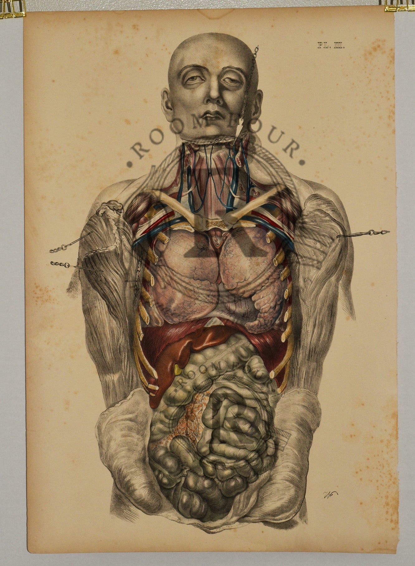 Anatomical Folio Art Surgical Post Mortem 19th Century - Room Four