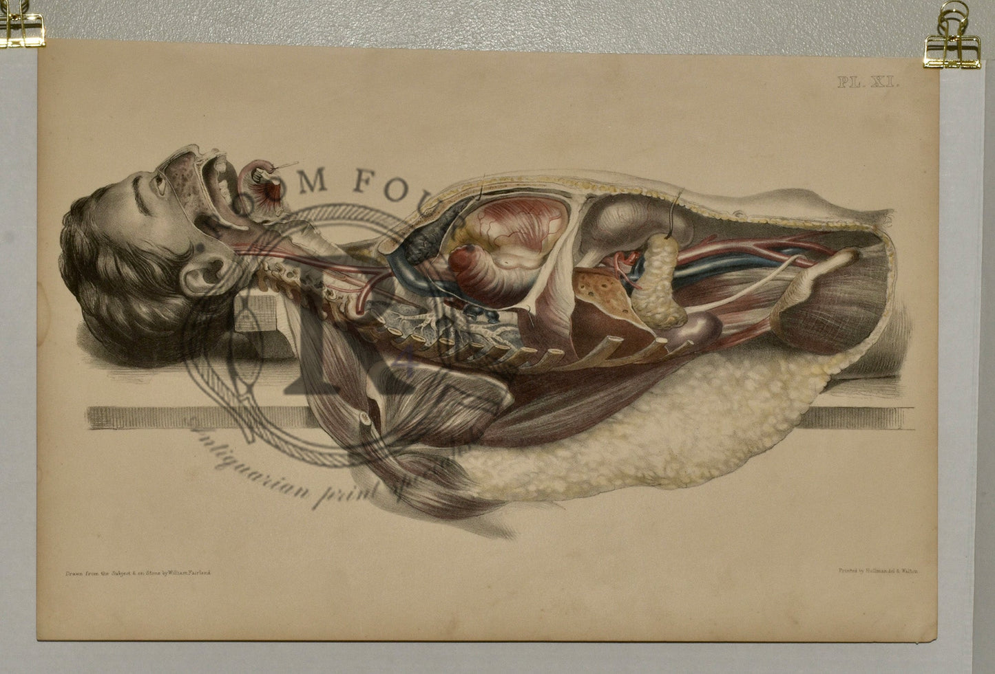 Anatomical Folio Art Surgical Post Mortem 19th Century - Room Four