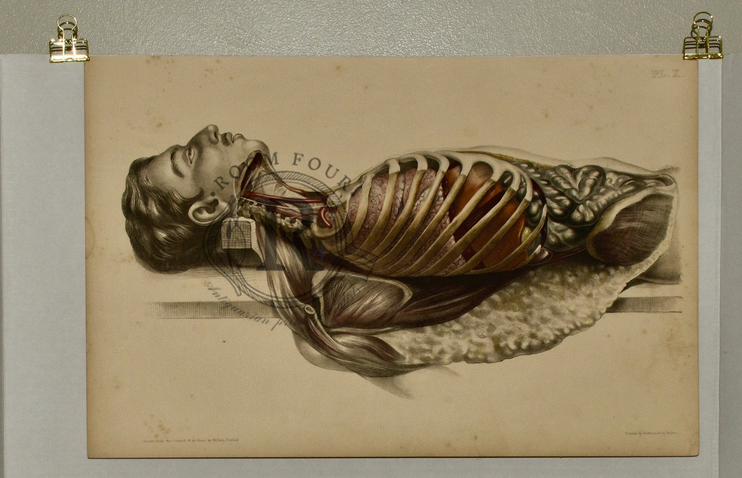 Anatomical Folio Art Surgical Post Mortem 19th Century - Room Four