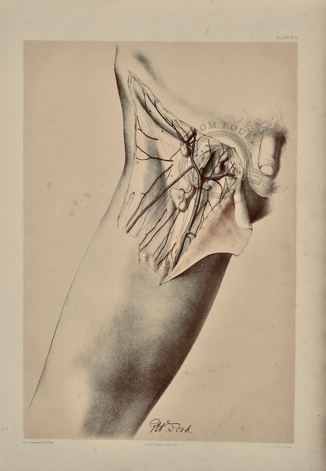 Anatomical Medical Dissection Drawing, Upper Leg plate XLII - Room Four