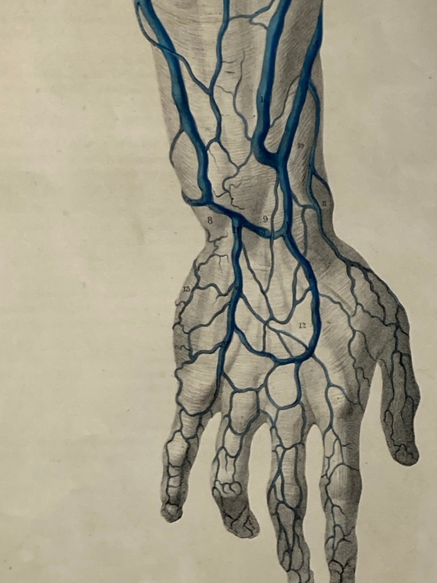 Anatomical Original Artwork - Vascular Hands & Arm 36 - Room Four