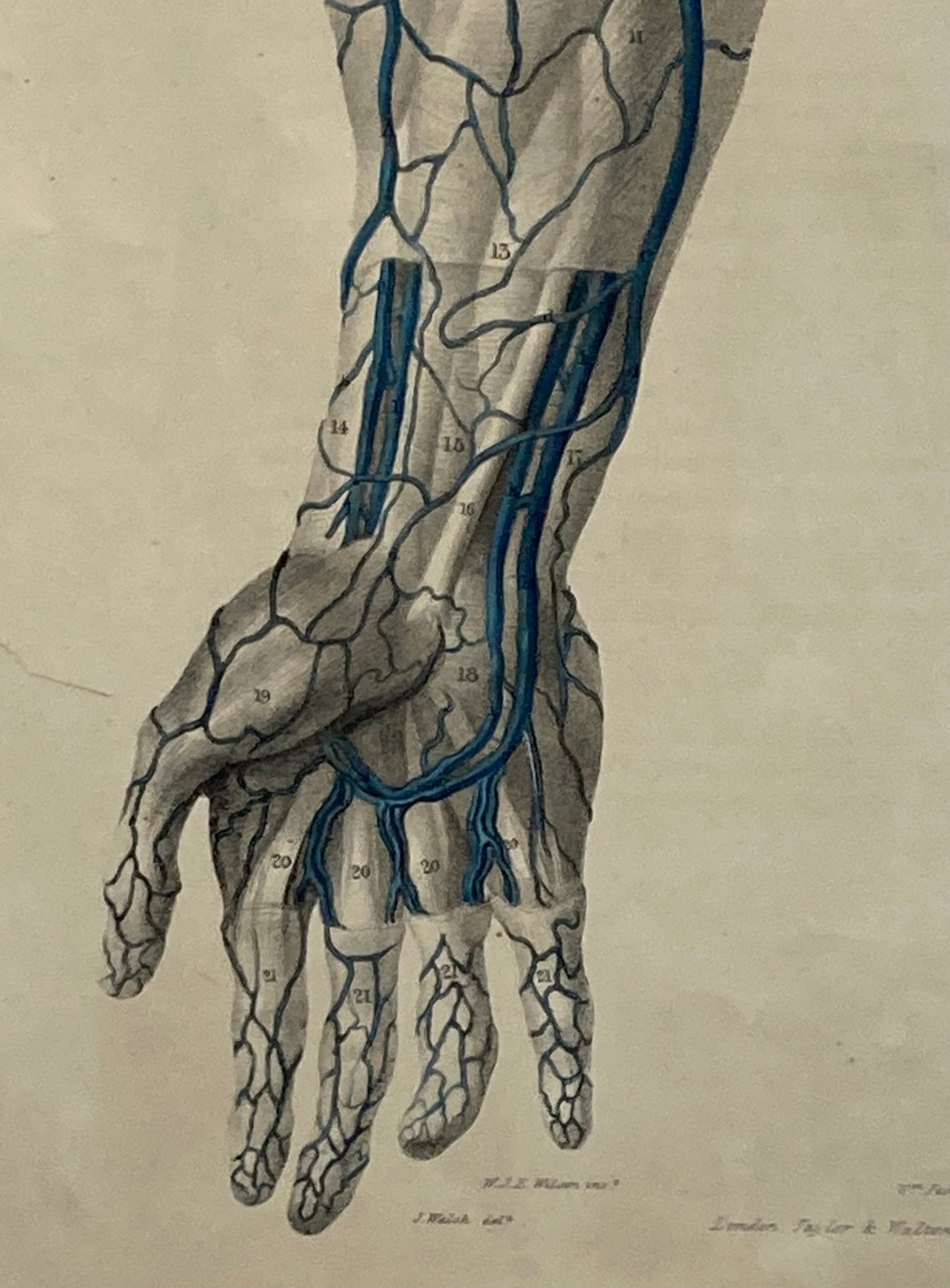 Anatomical Original Artwork - Vascular Hands & Arm 36 - Room Four