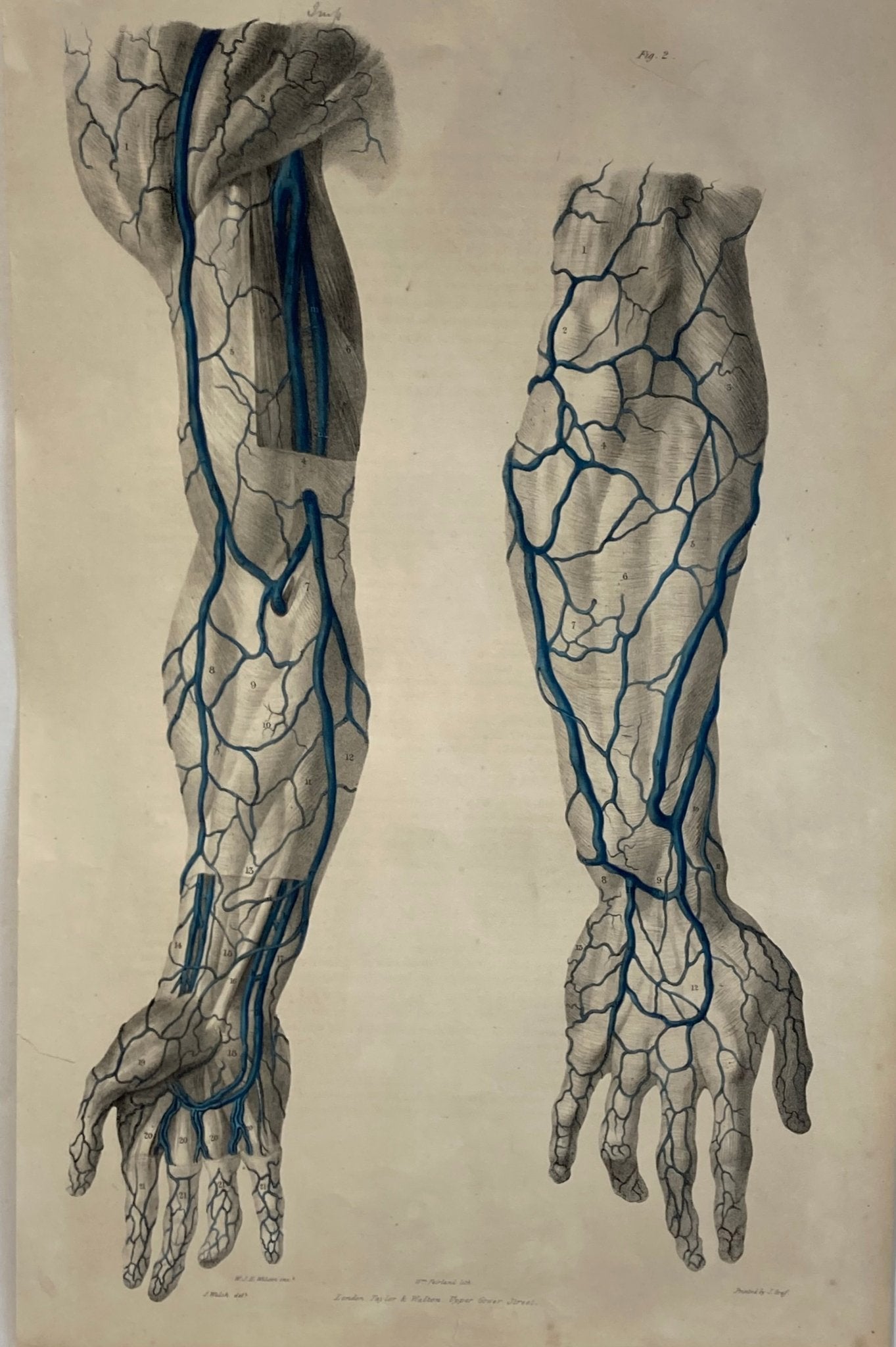 Anatomical Original Artwork - Vascular Hands & Arm 36 - Room Four