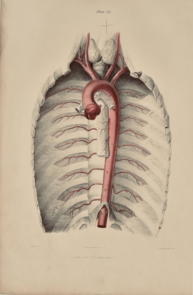 Anatomical Original Wall Art - Vascular 13 - Room Four