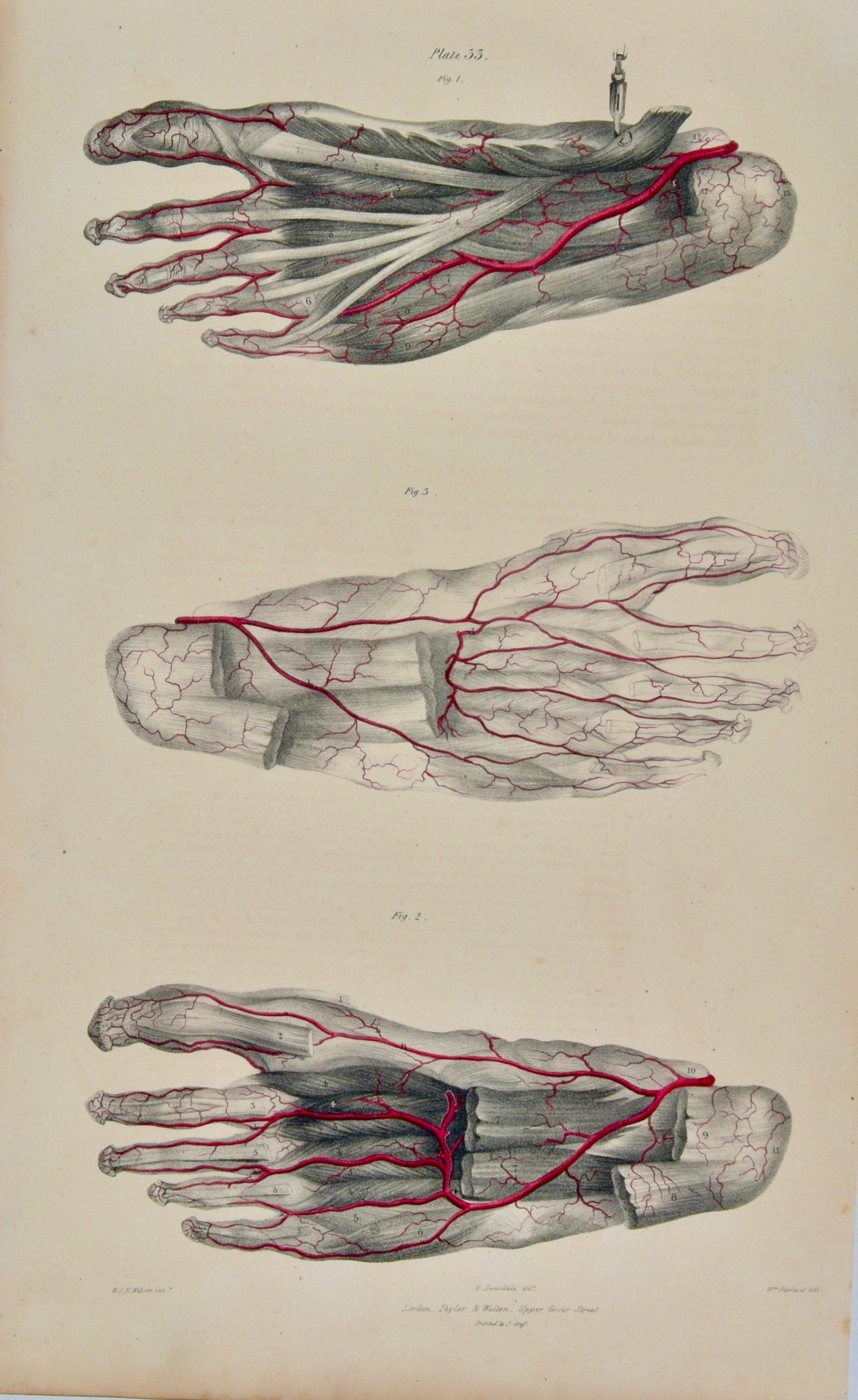 Anatomical Original Wall Art - Vascular Feet - 33 - Room Four