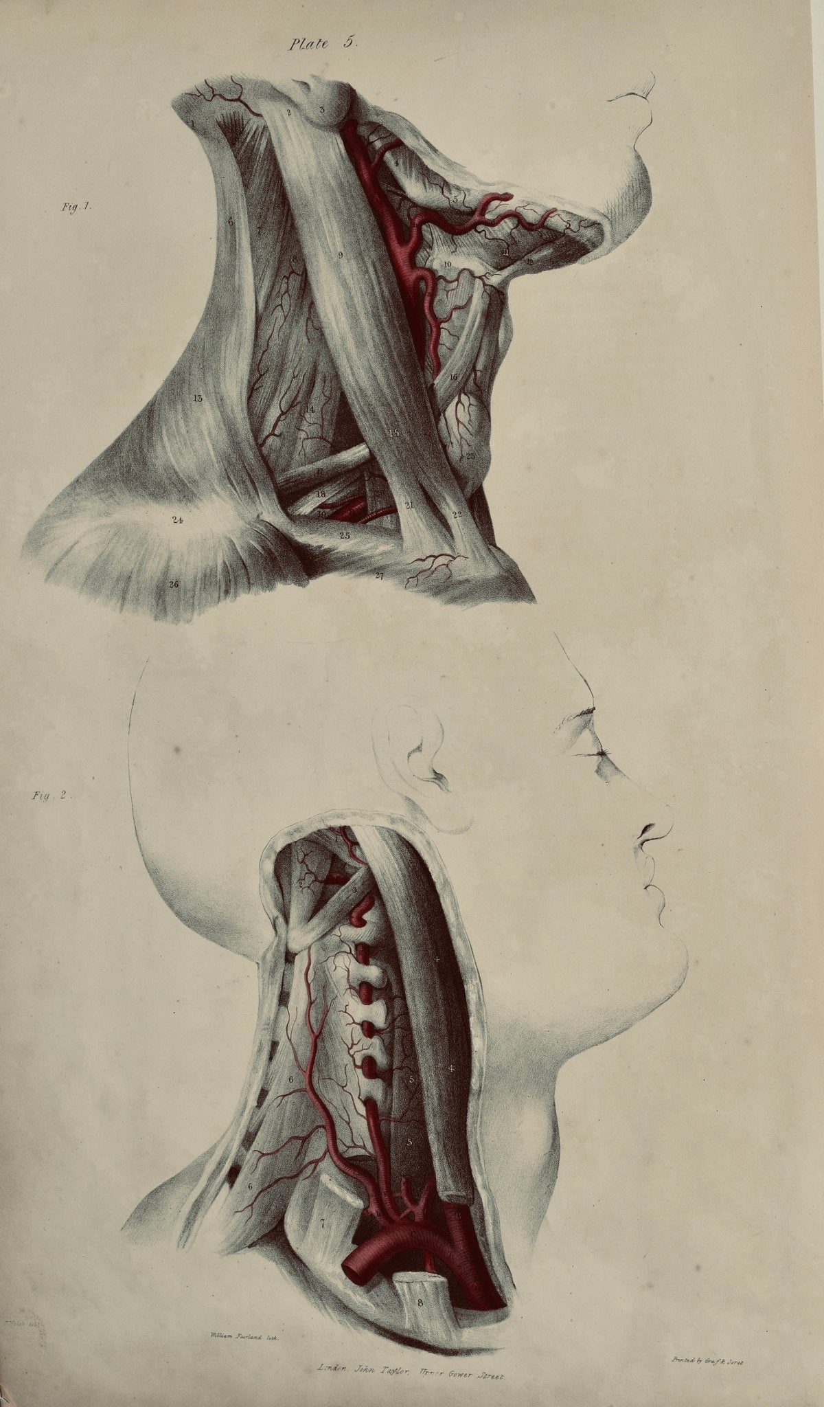 Anatomical Original Wall Art - Vascular Head & Neck 5 - Room Four