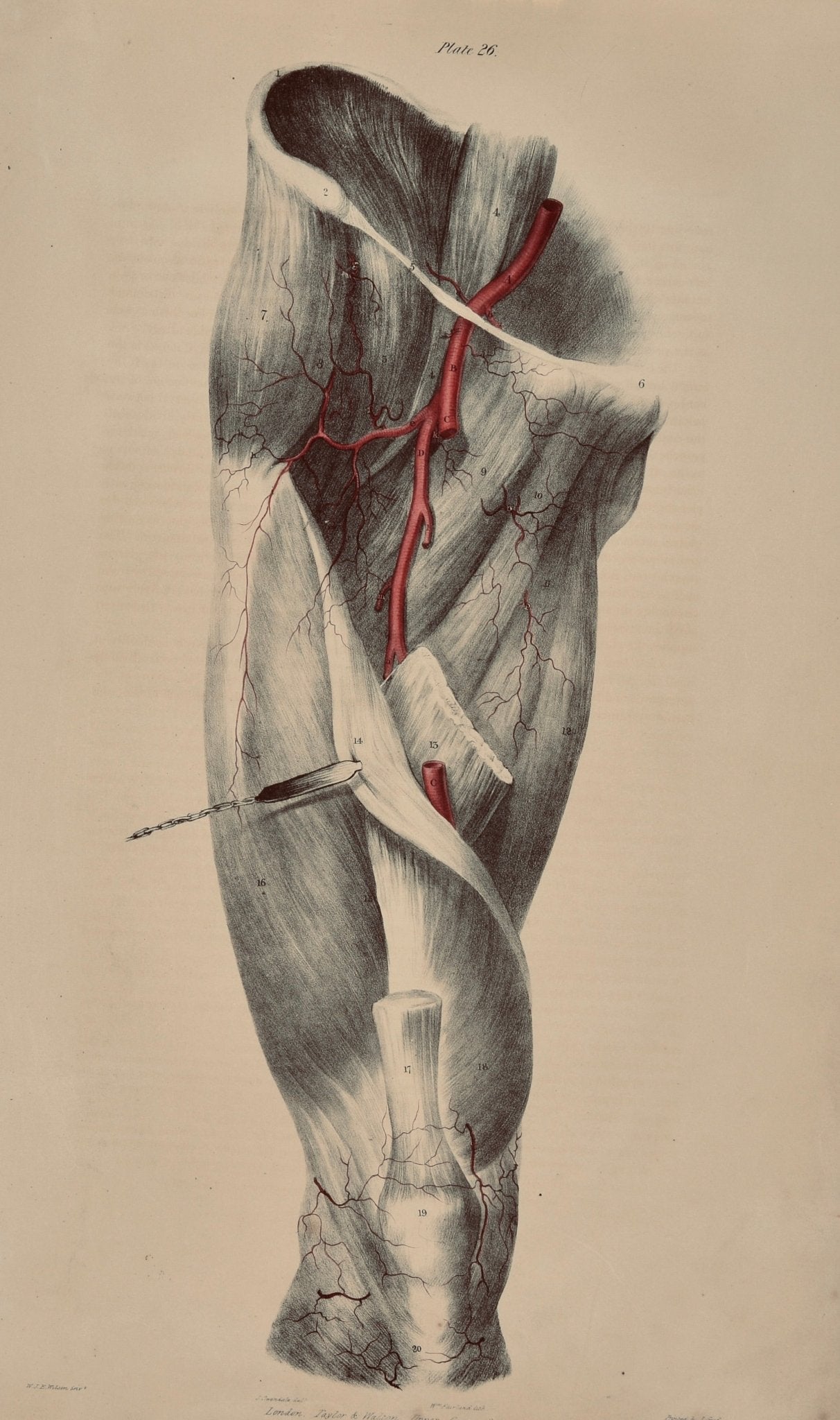 Anatomical Original Wall Art - Vascular Leg 26 - Room Four