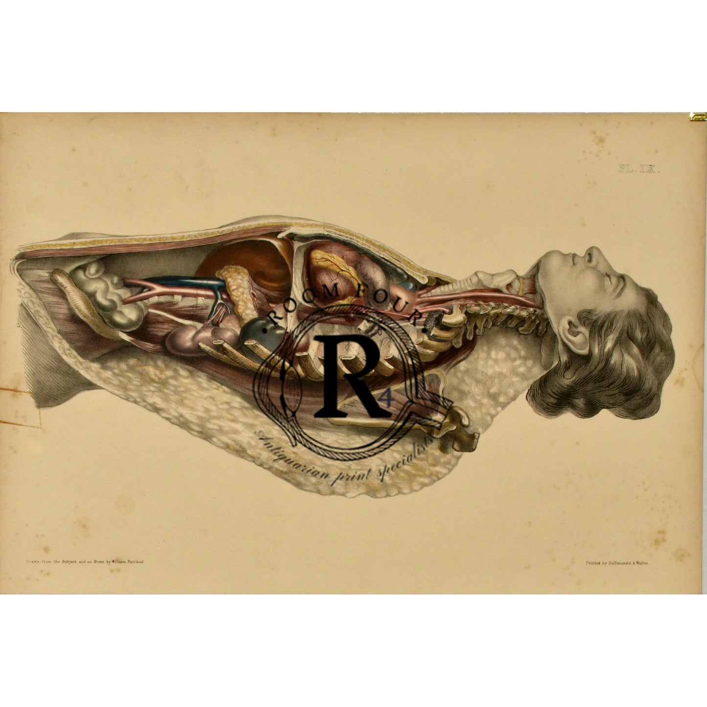 Human Anatomy Lithographic Print 19th Century - Plate XX