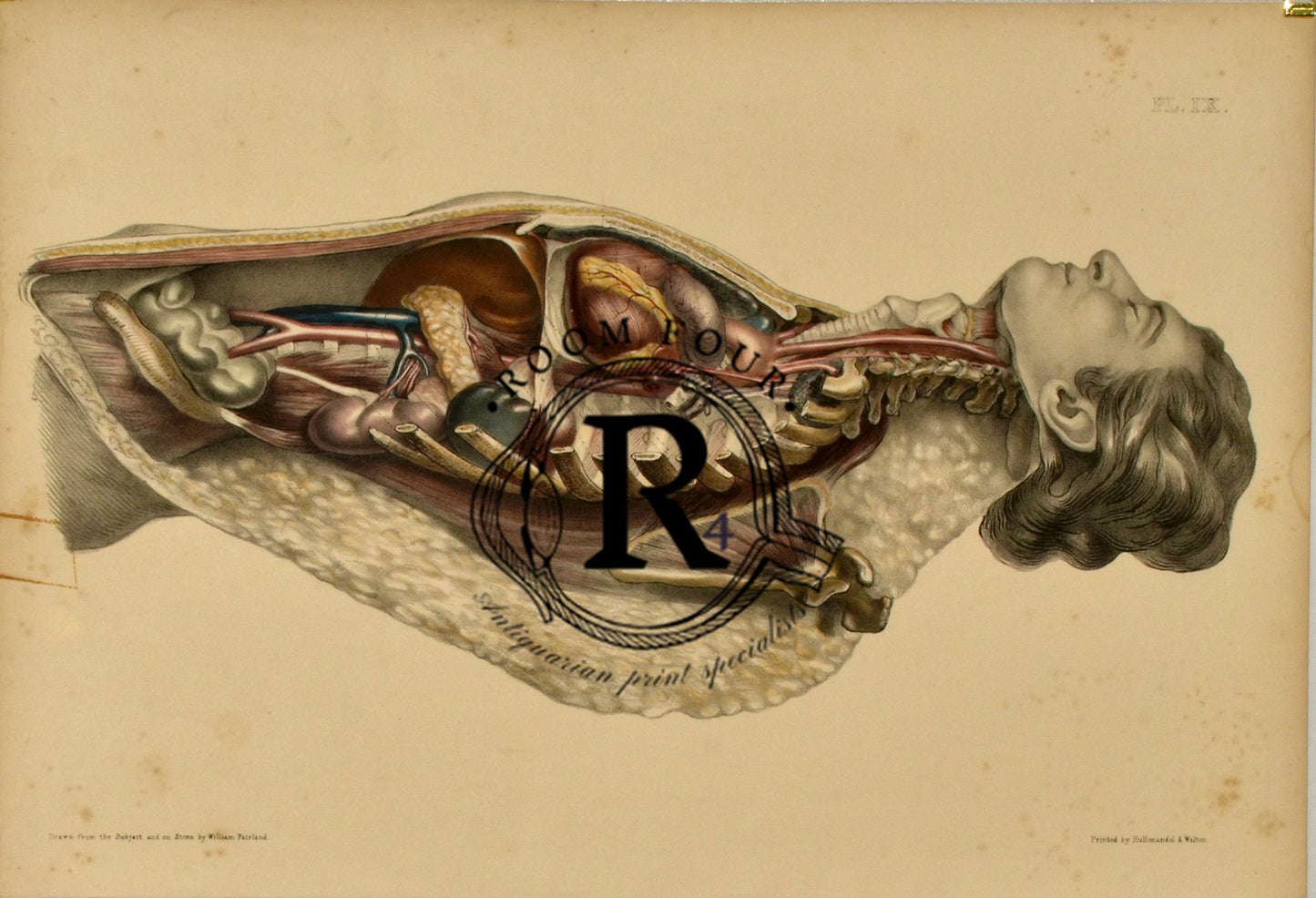 Human Anatomy Lithographic Print 19th Century - Plate XX