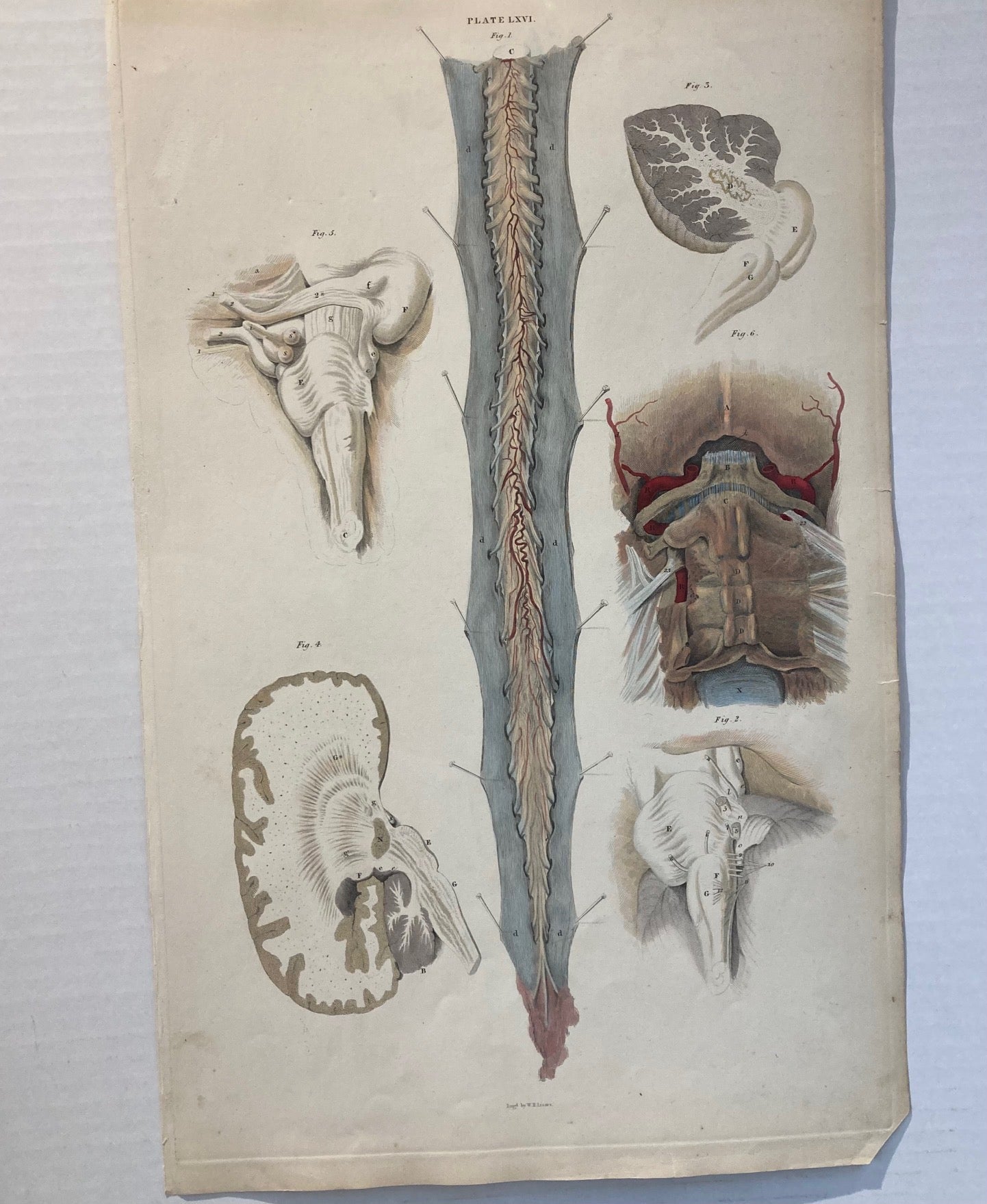 Early Anatomy - Plate LXVI - ORIGINAL - Room Four