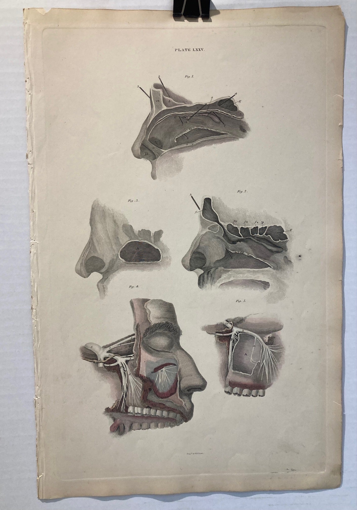 Early Anatomy - Plate LXXV - ORIGINAL - Room Four