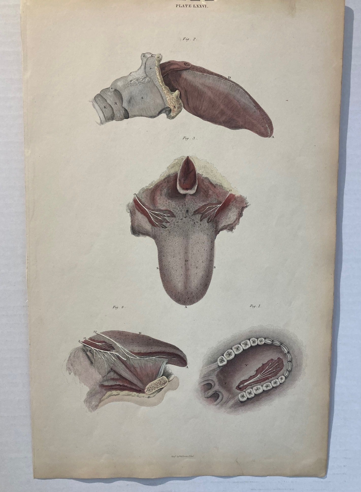 Early Anatomy - Plate LXXVI - ORIGINAL - Room Four