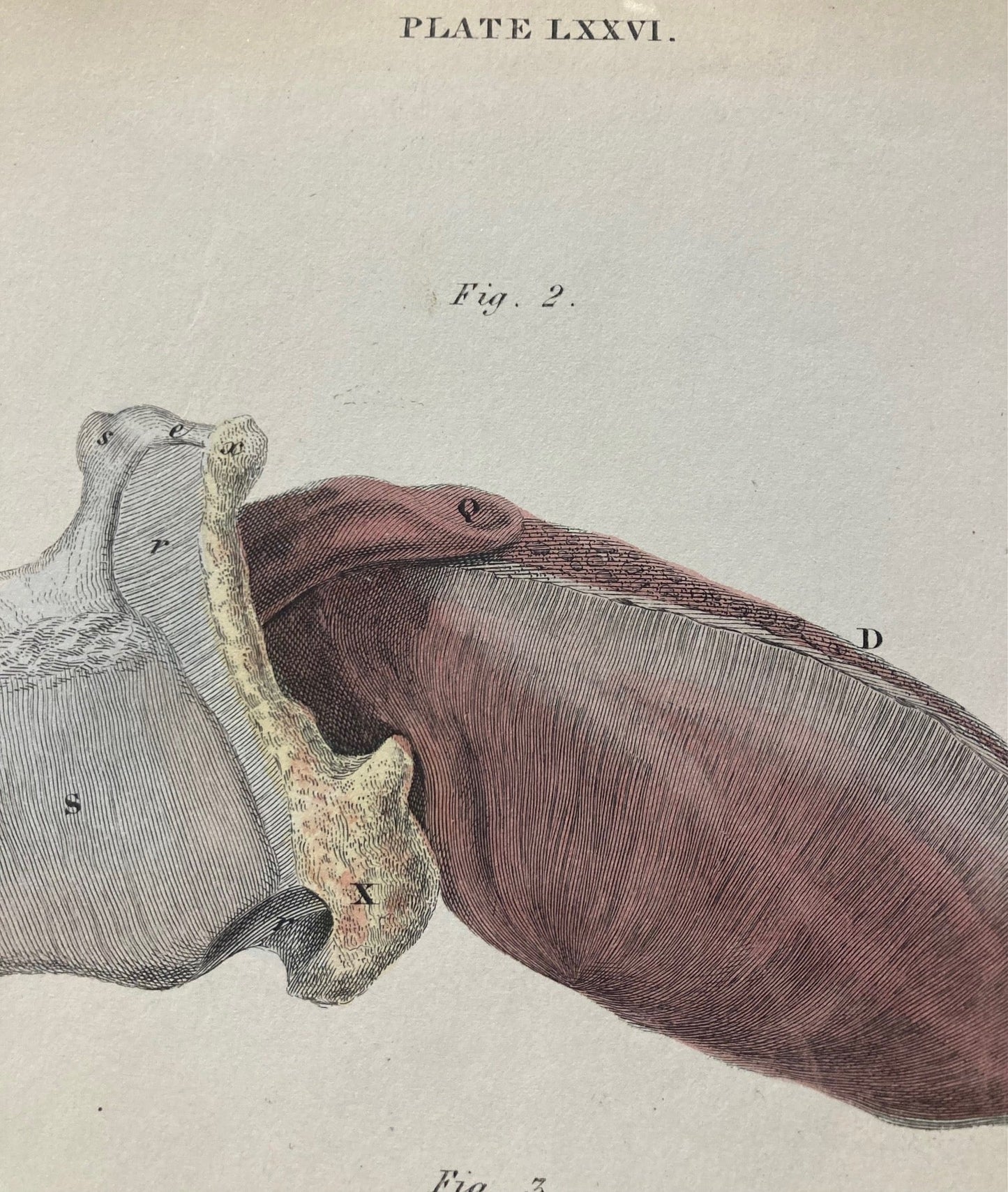 Early Anatomy - Plate LXXVI - ORIGINAL - Room Four
