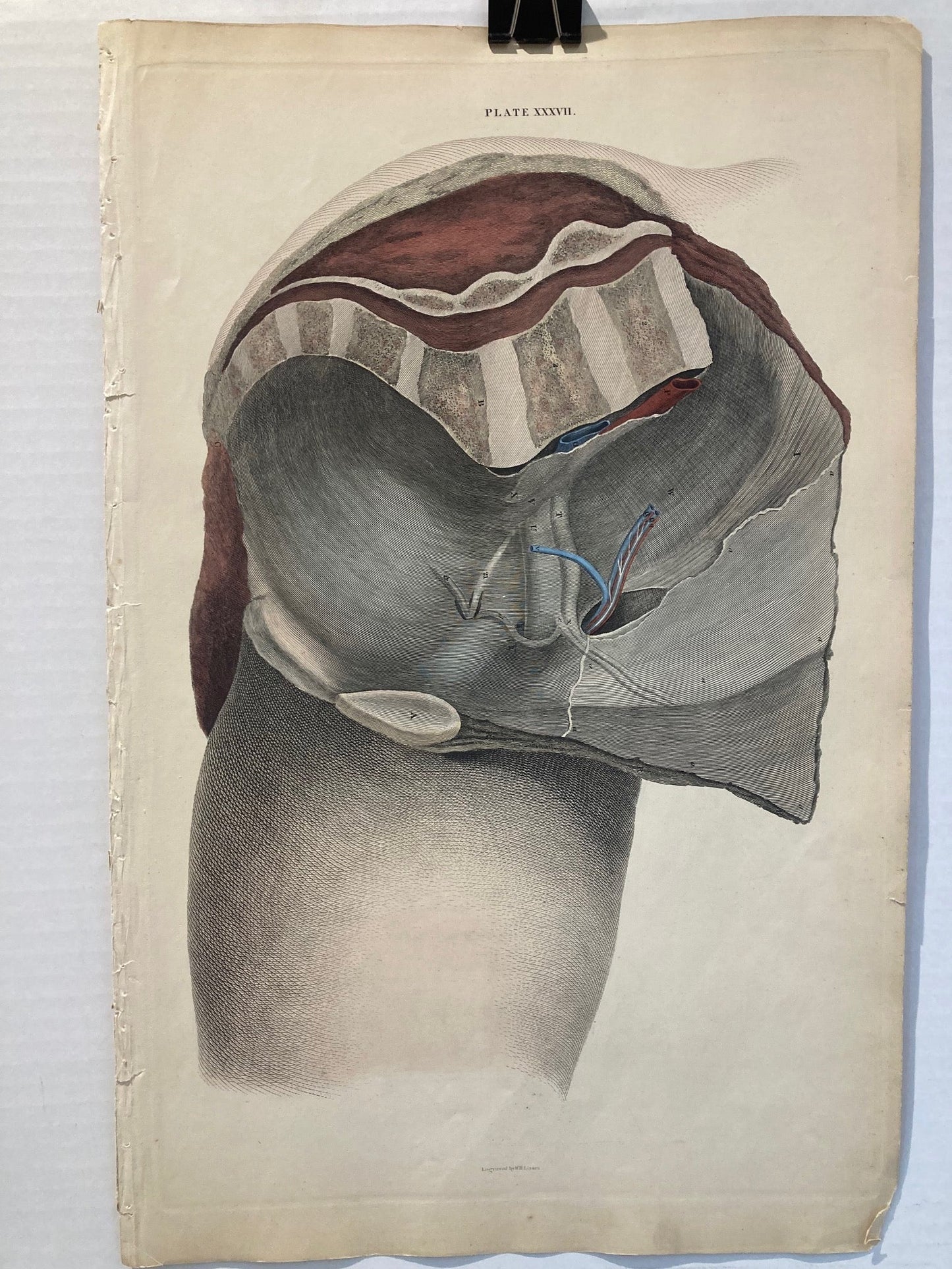 Early Anatomy - Plate XXXVI - ORIGINAL - Room Four