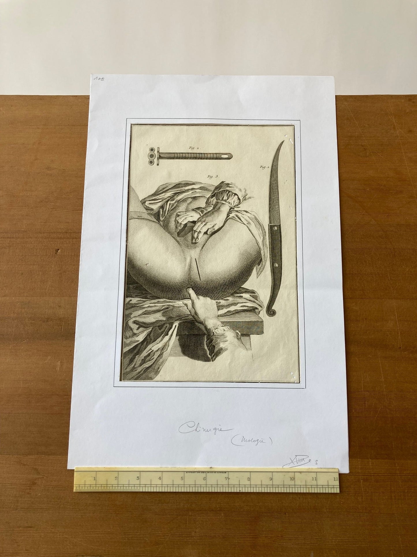 Early Surgical Engraving - French - Room Four
