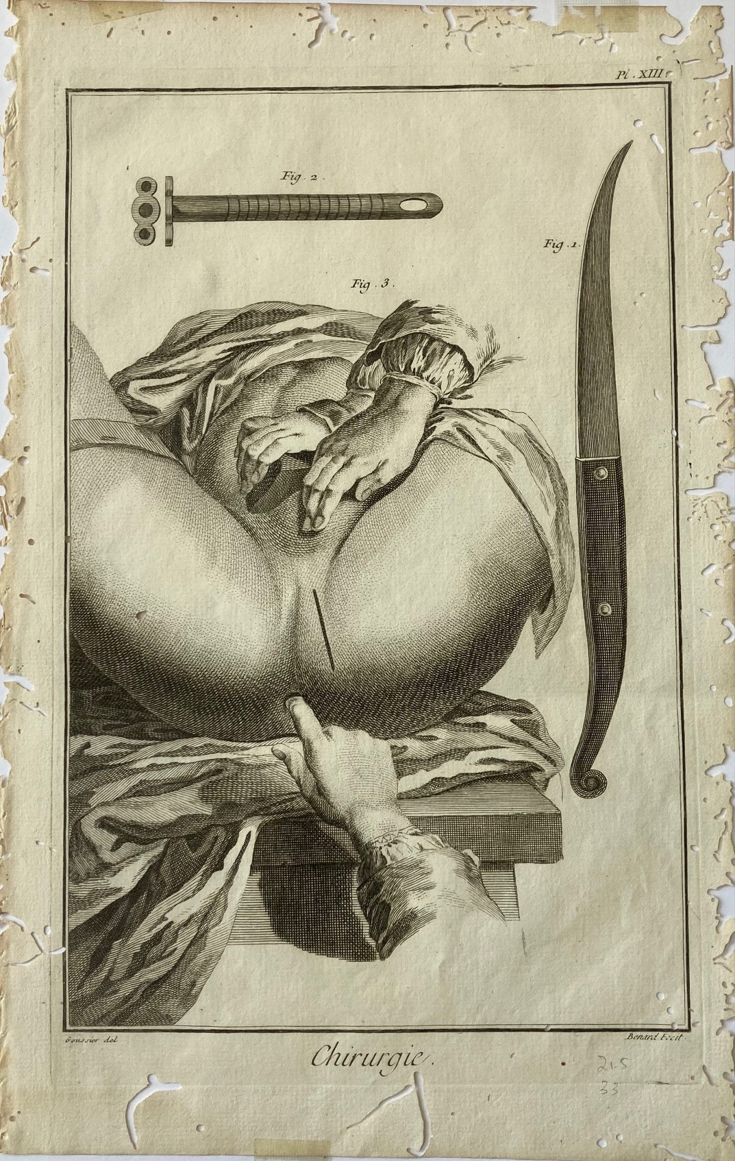 Early Surgical Engraving - French - Room Four