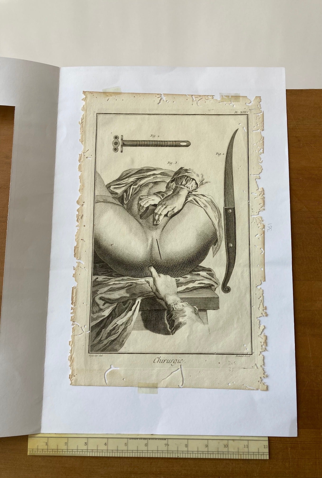 Early Surgical Engraving - French - Room Four