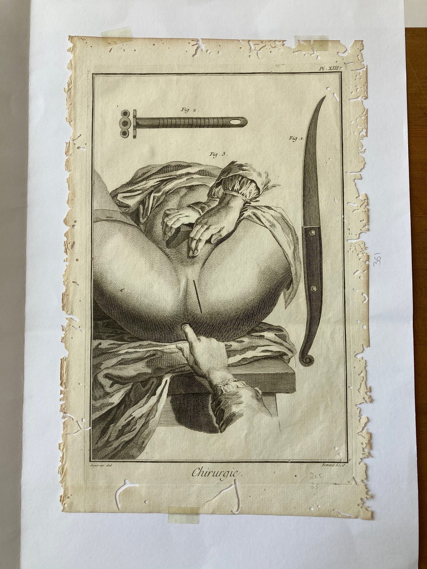 Early Surgical Engraving - French - Room Four
