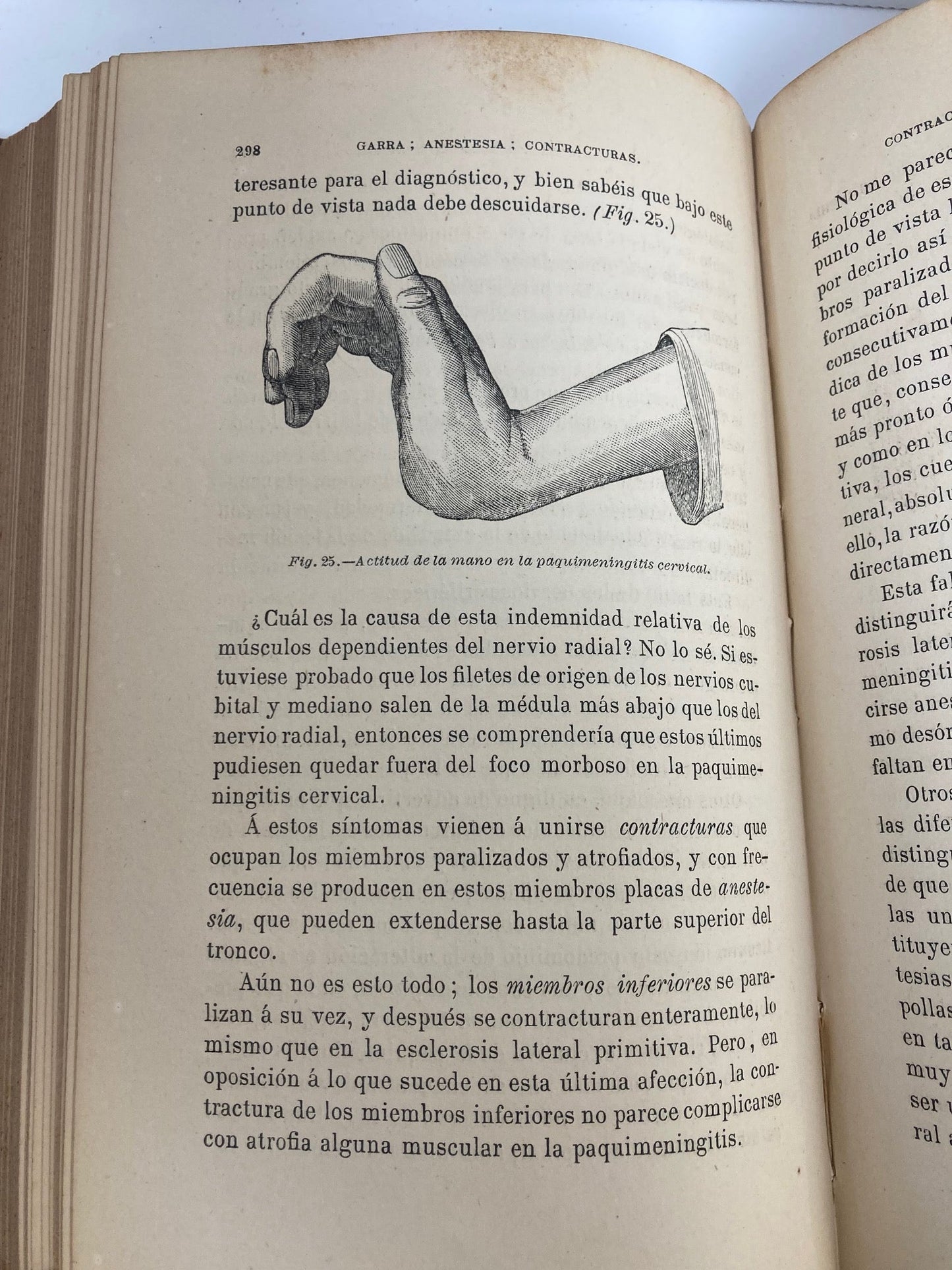 Enfermedades del Sistema Nervioso (2 Volumes) - Room Four