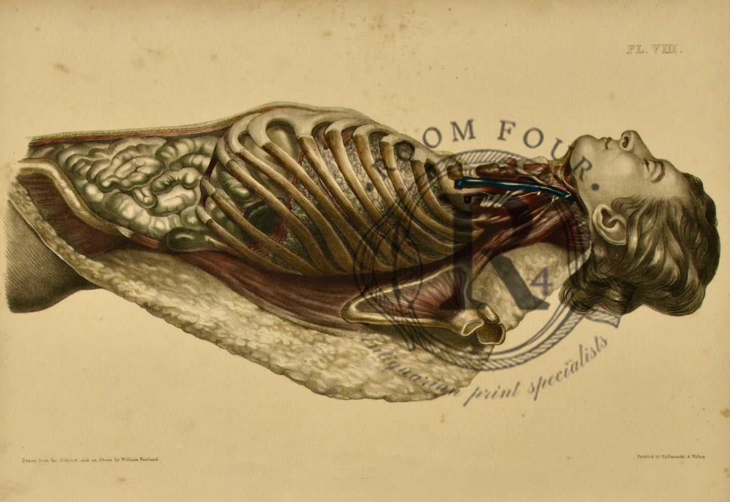 Human Anatomy Lithographic Print 19th Century - Plate VIII - Room Four