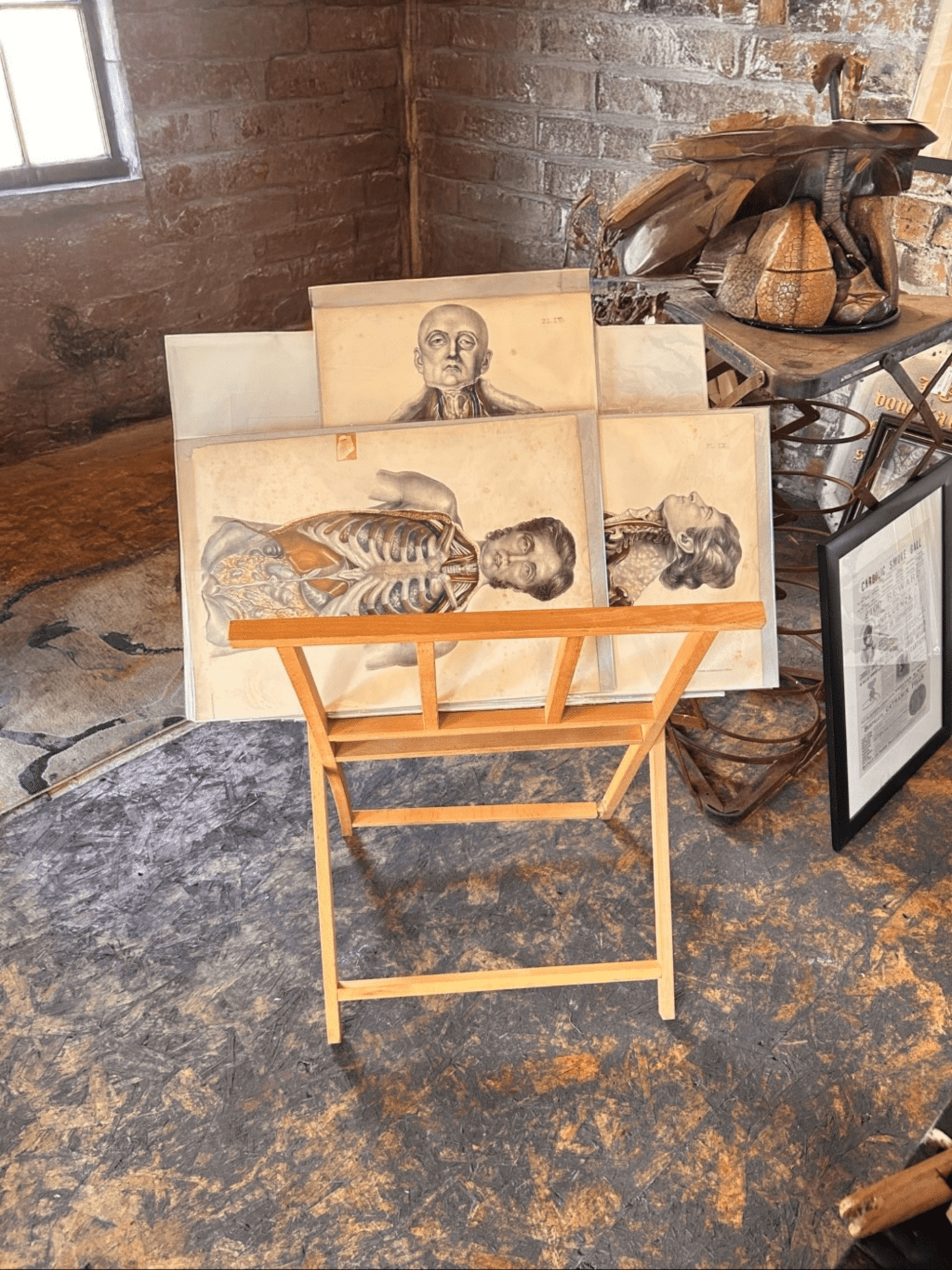 Human Anatomy Lithographic Print 19th Century - Plate VIII - Room Four