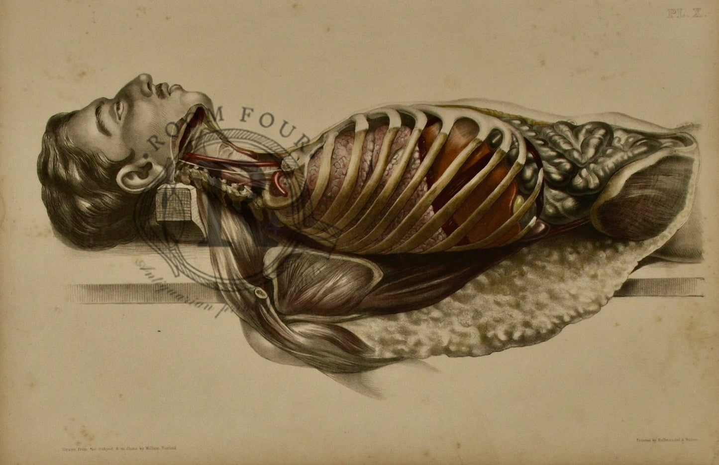 Human Anatomy Lithographic Print 19th Century - Plate X - Room Four