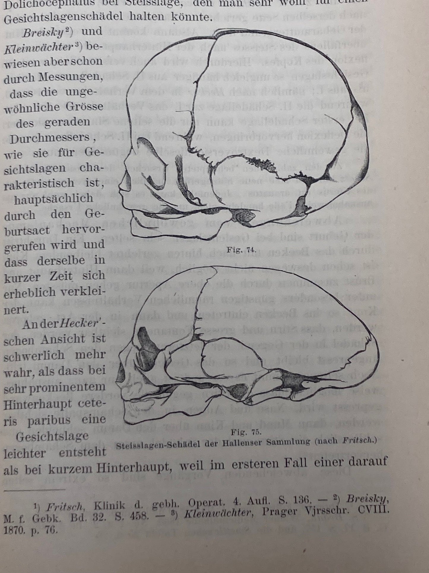 (Obstetrics) Lehrbuch der Geburtshilfe - 1891 - Room Four