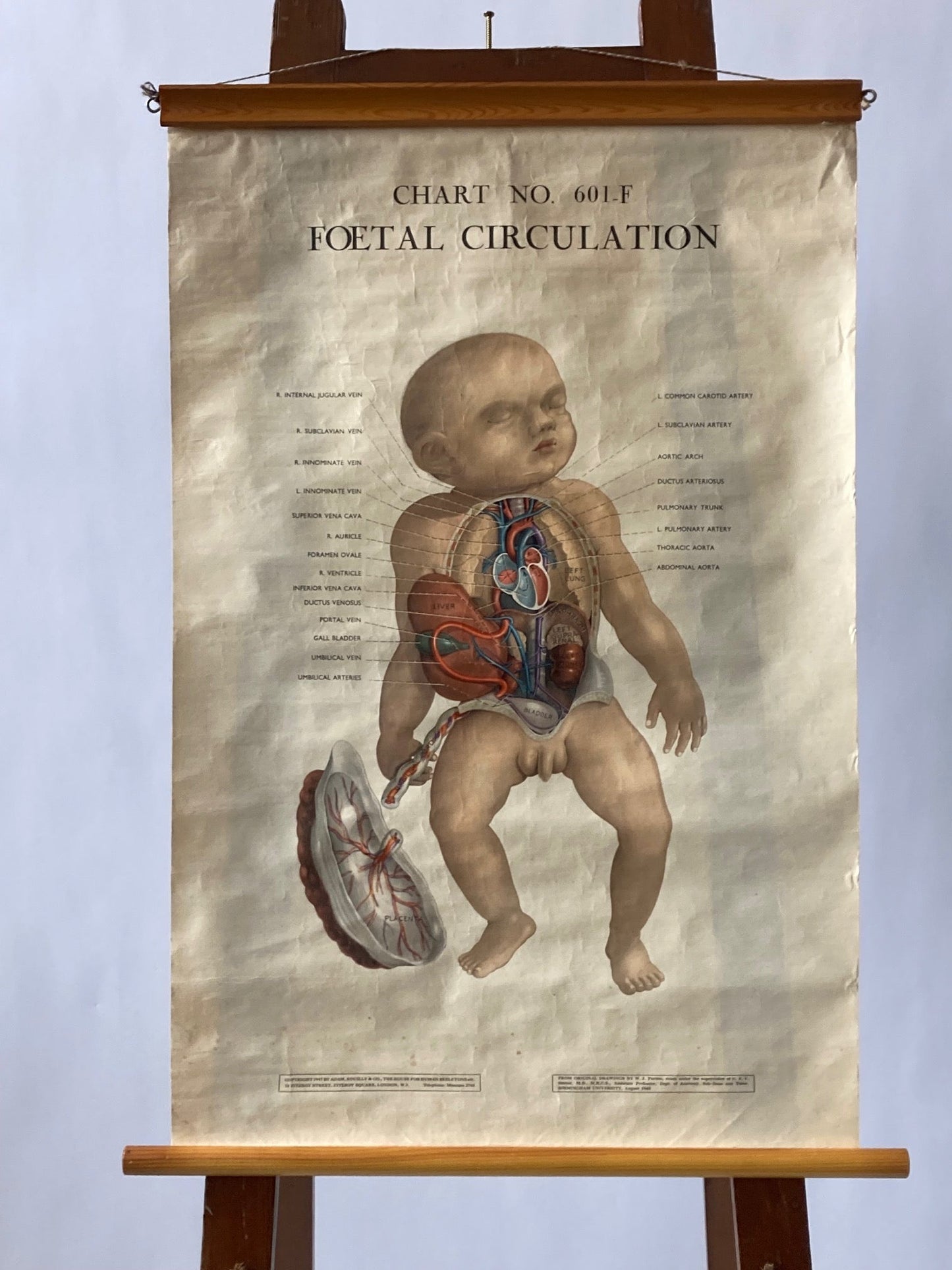 PAEDIATRICS Wall Chart Foetal Circulation , 1940's - Room Four