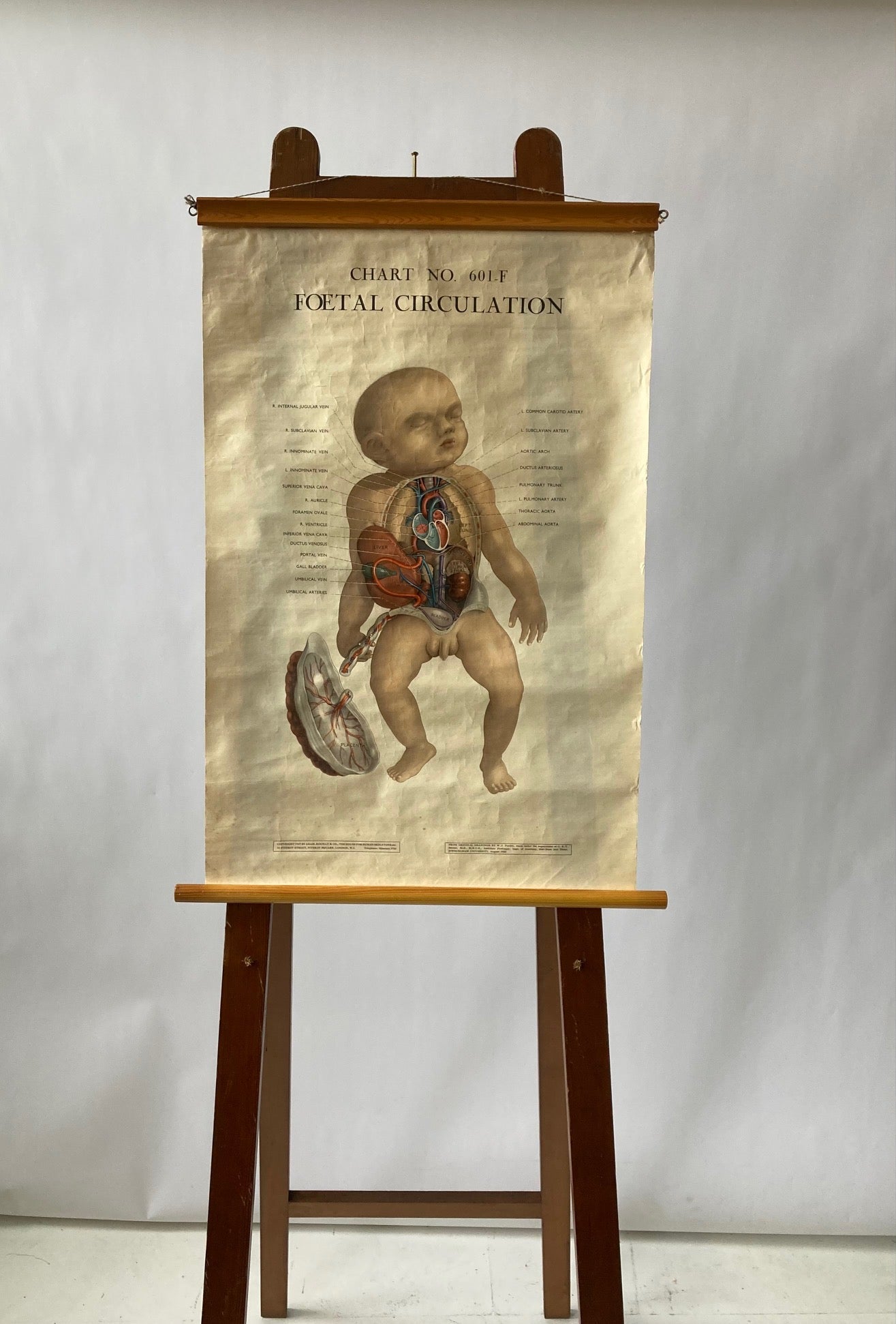 PAEDIATRICS Wall Chart Foetal Circulation , 1940's - Room Four