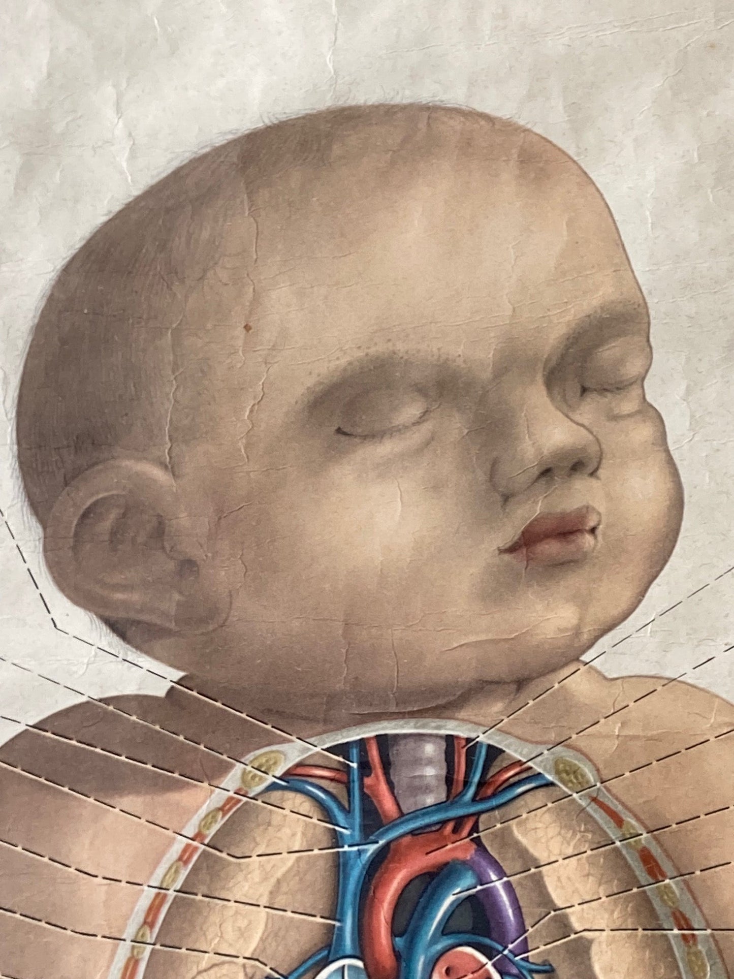 PAEDIATRICS Wall Chart Foetal Circulation , 1940's - Room Four